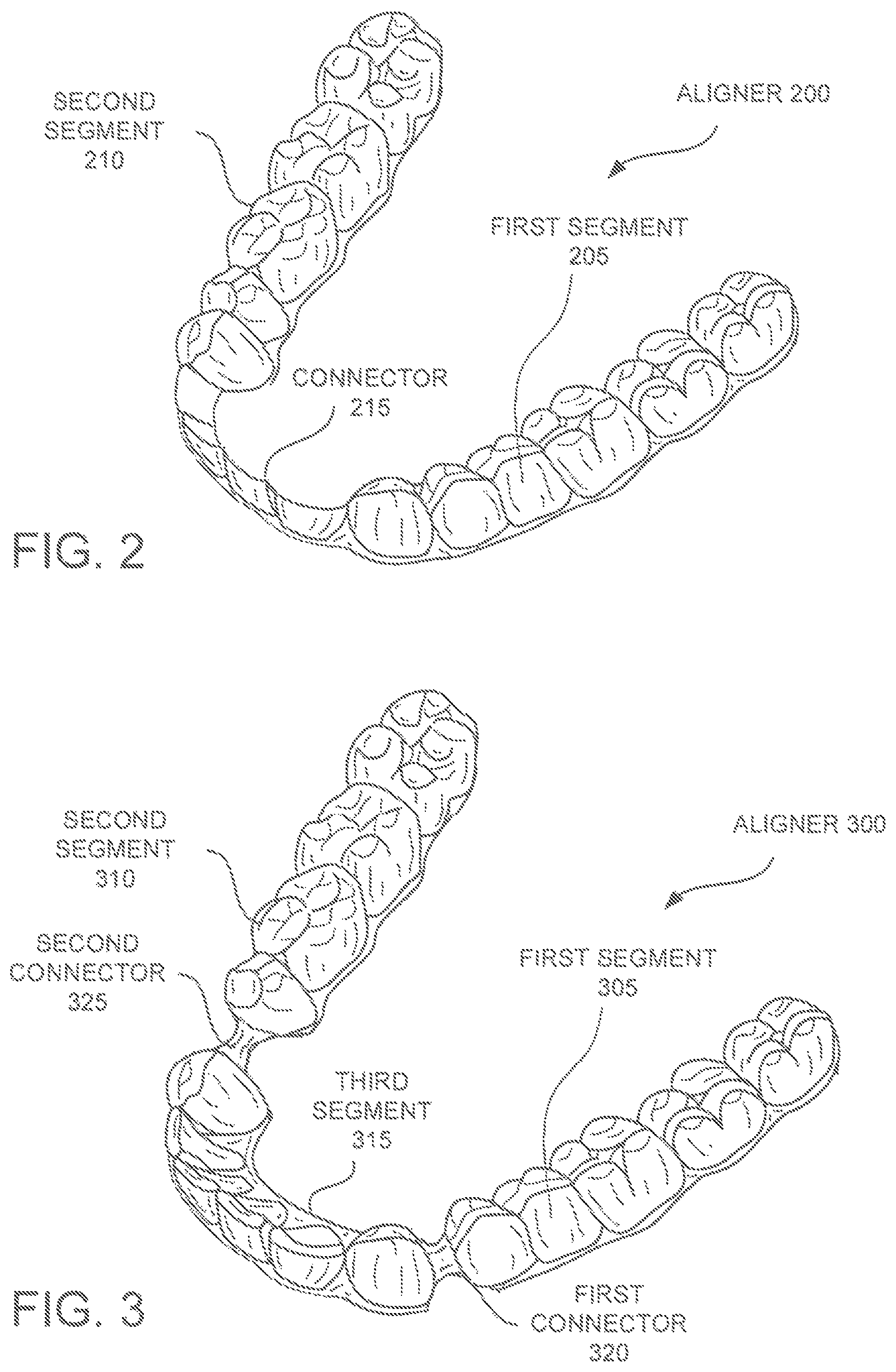 Patent US12350121 Figure 2 – Orthodontic aligner with isolated segments