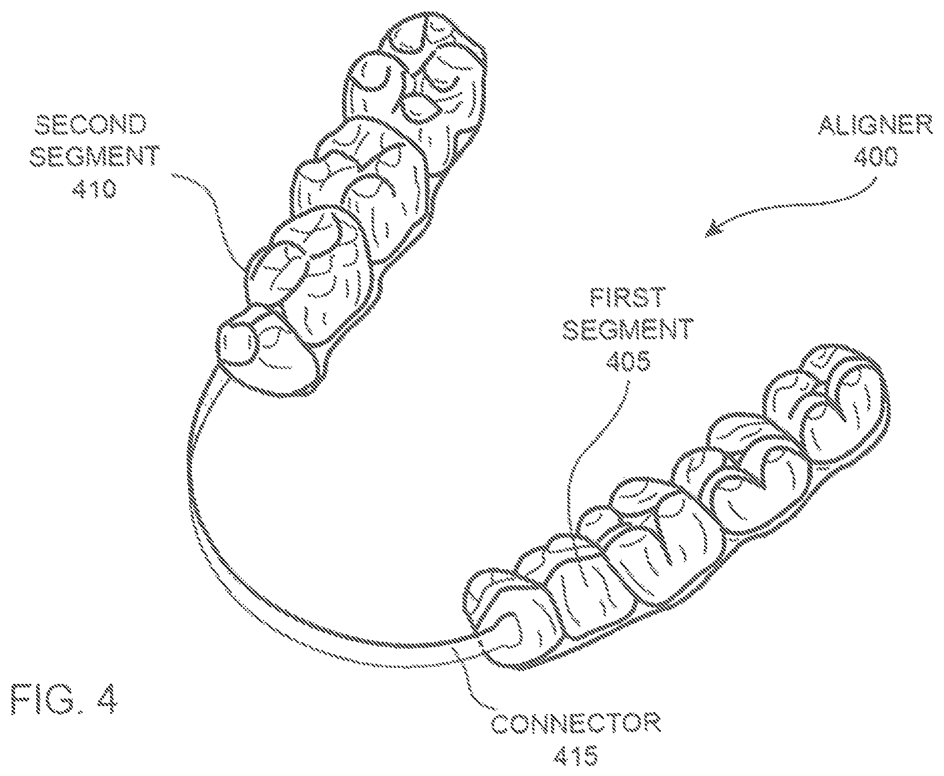 Patent US12350121 Figure 3 – Orthodontic aligner with isolated segments