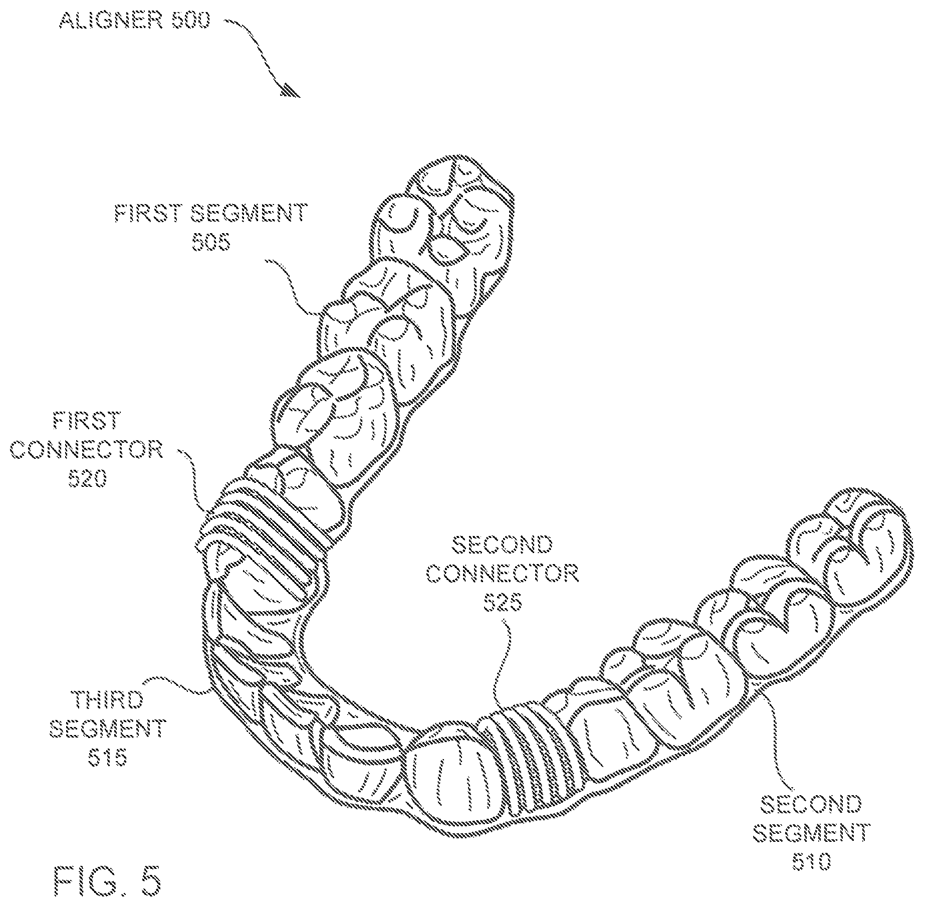 Patent US12350121 Figure 4 – Orthodontic aligner with isolated segments