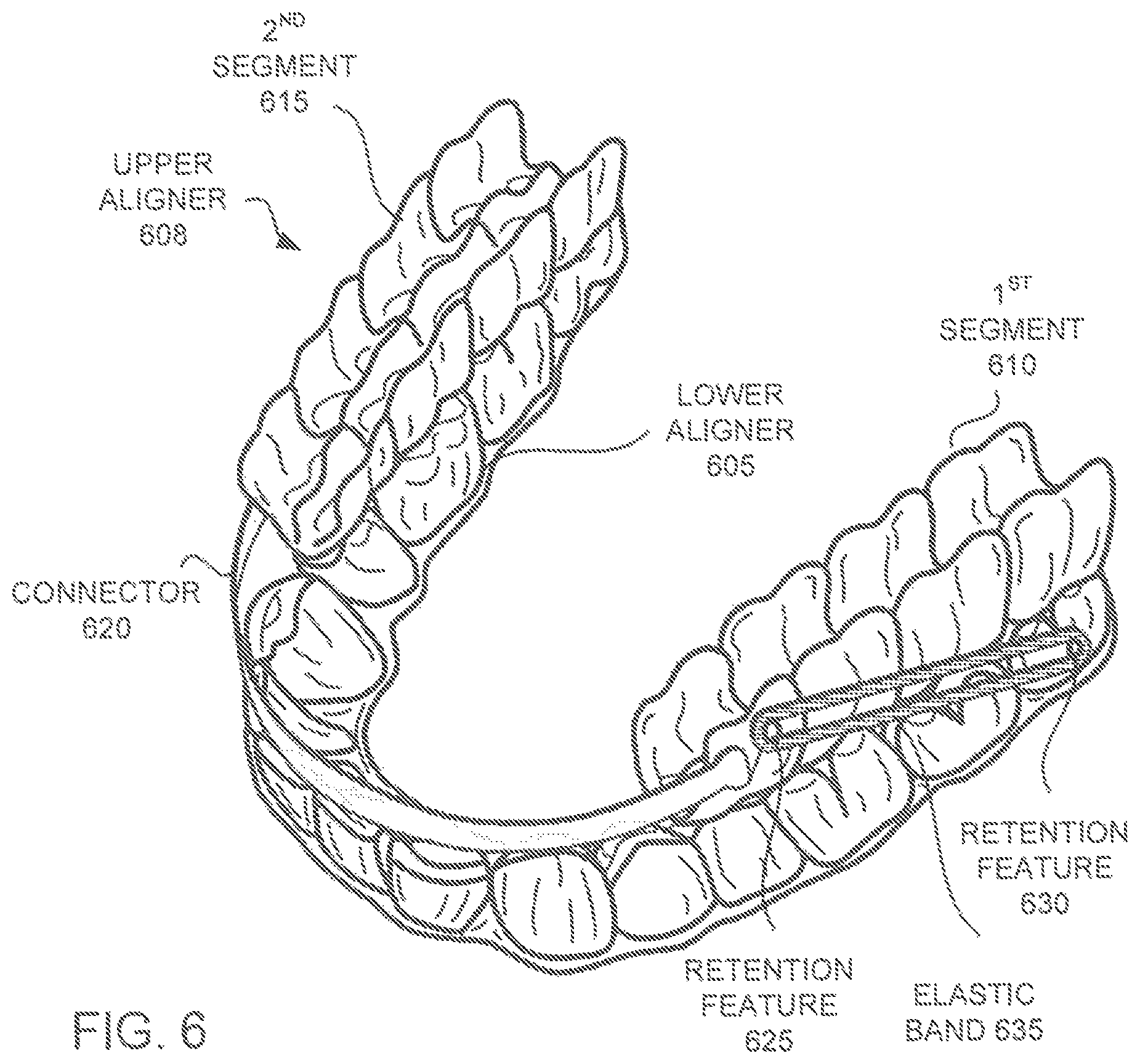 Patent US12350121 Figure 5 – Orthodontic aligner with isolated segments