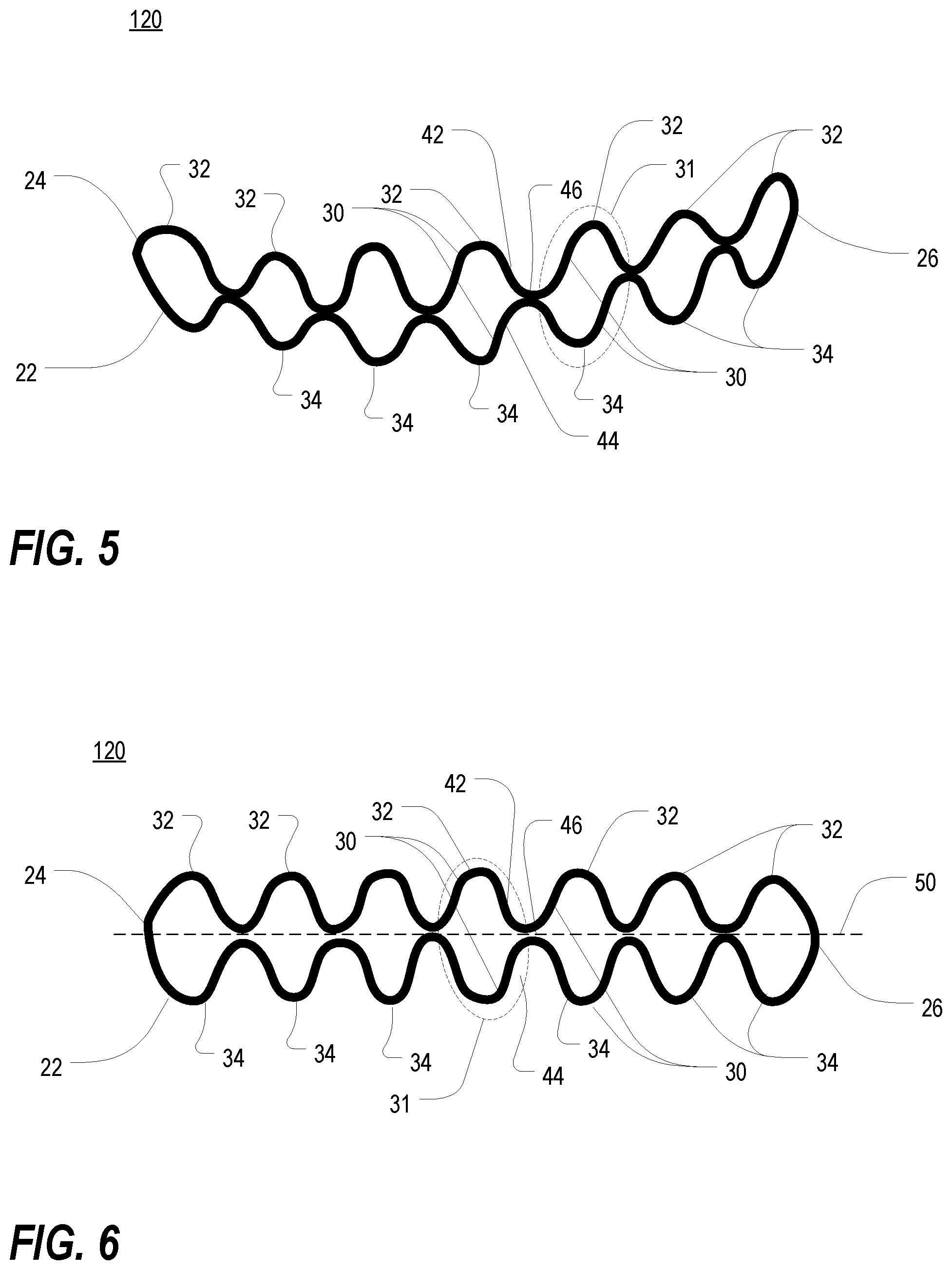 Patent US12350122 Figure 3 – Orthodontic device for lateral tooth movement