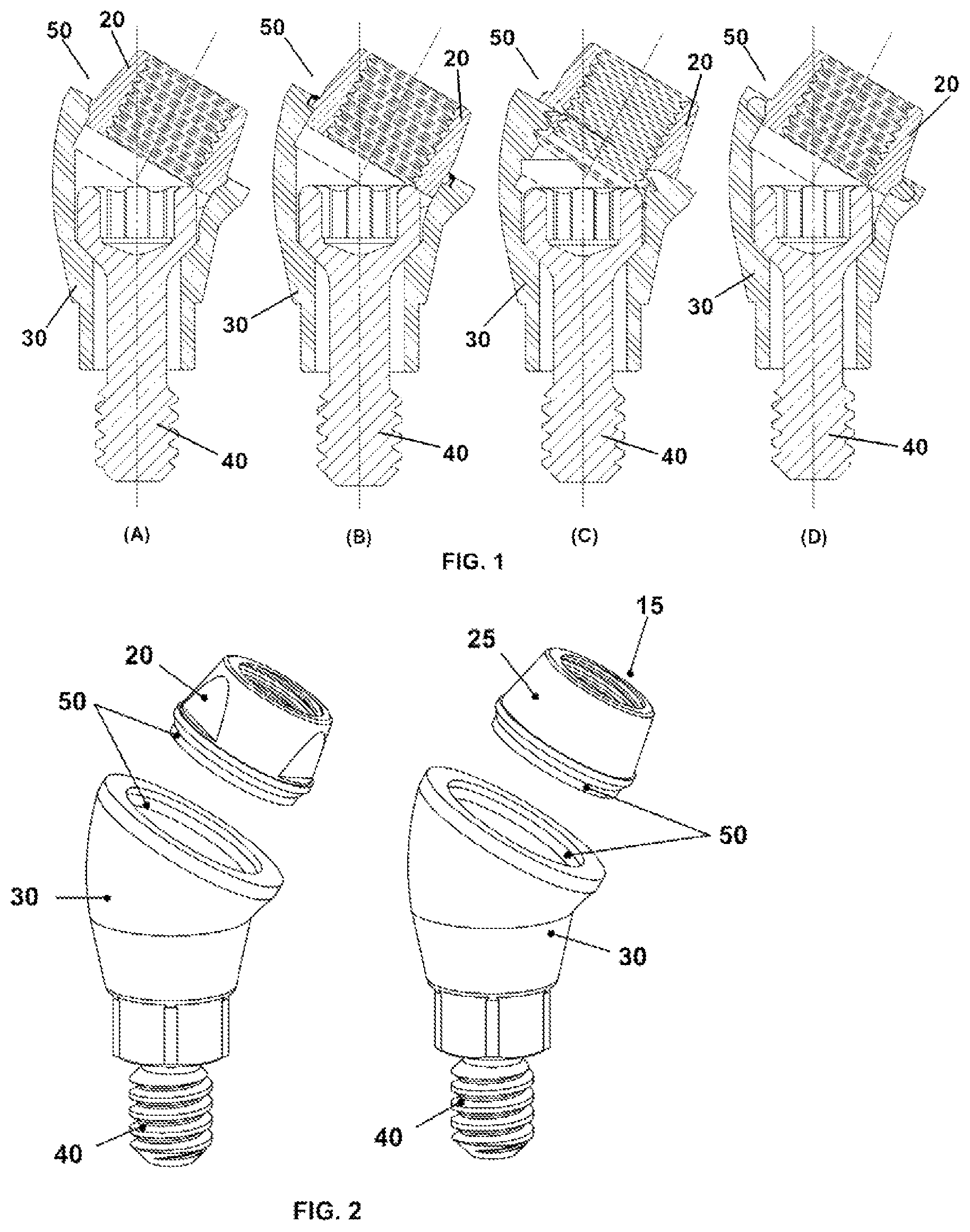 Patent US12350124 — Transepithelial abutment — Figure 1