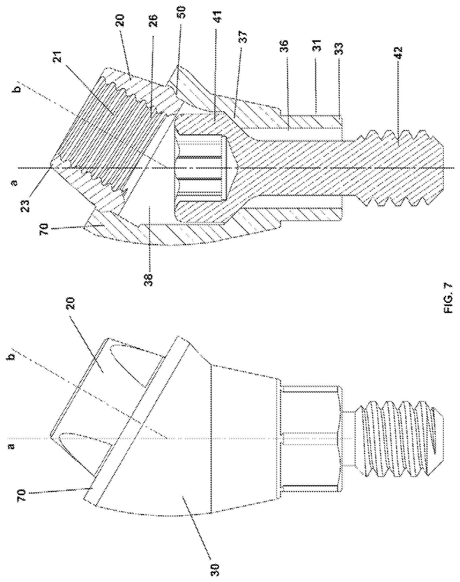Patent US12350124 Figure 4 – Transepithelial abutment
