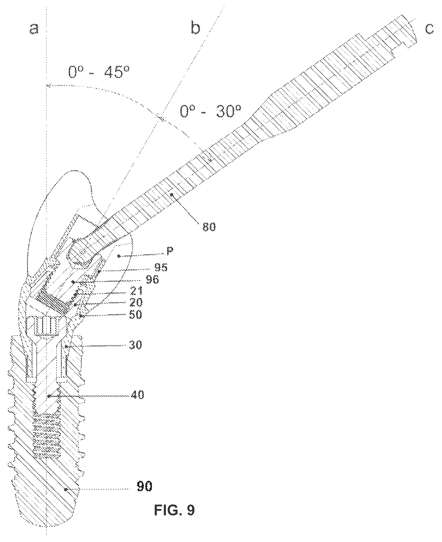 Patent US12350124 Figure 6 – Transepithelial abutment