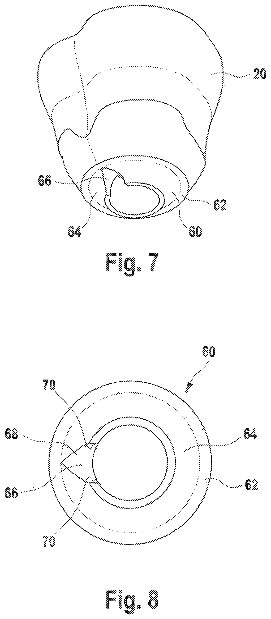 Patent US12350125 Figure 3 – Dental implant and dental prosthesis