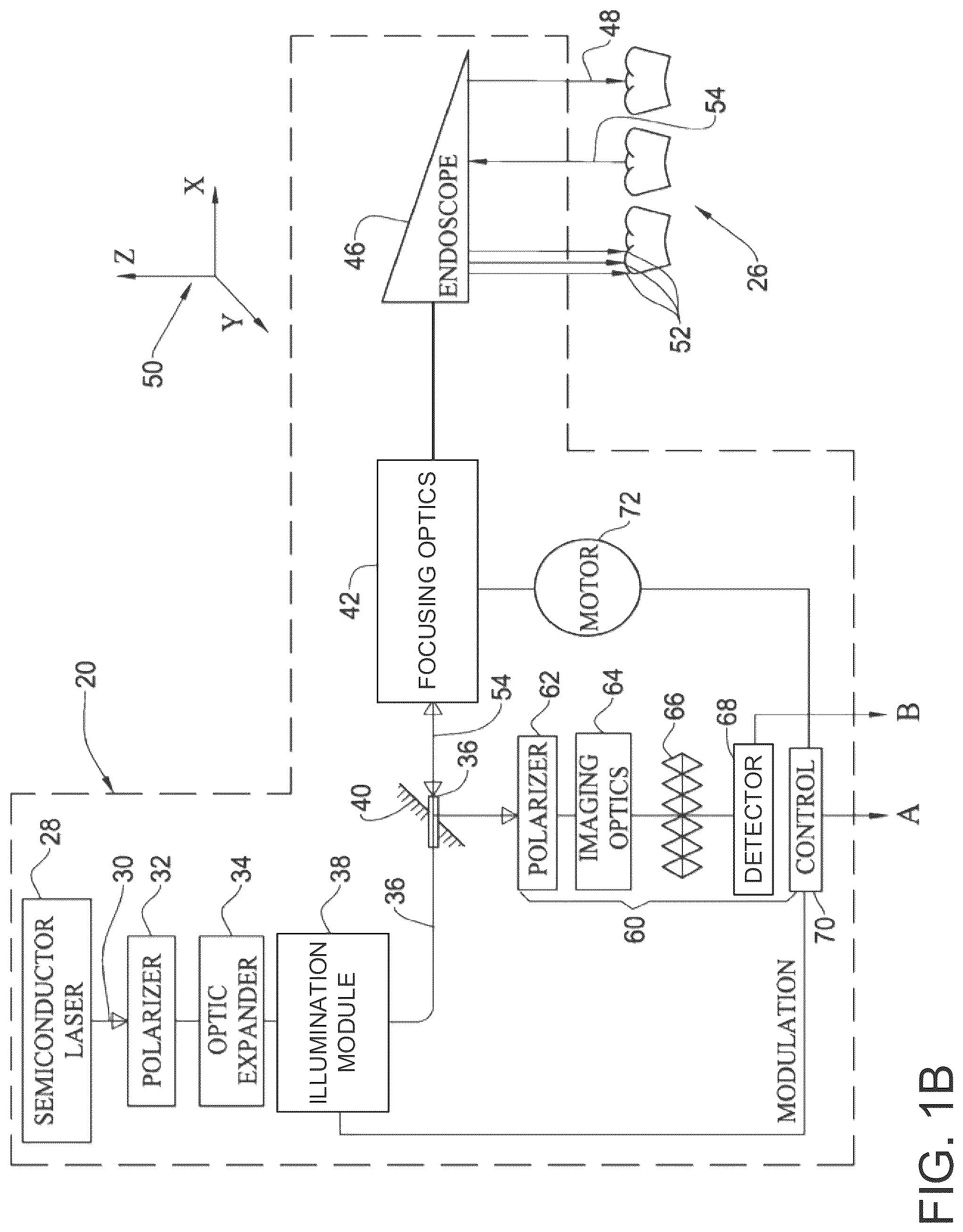 Patent US12350126 Figure 2 – Method generation of a sub-gingival surface of a tooth