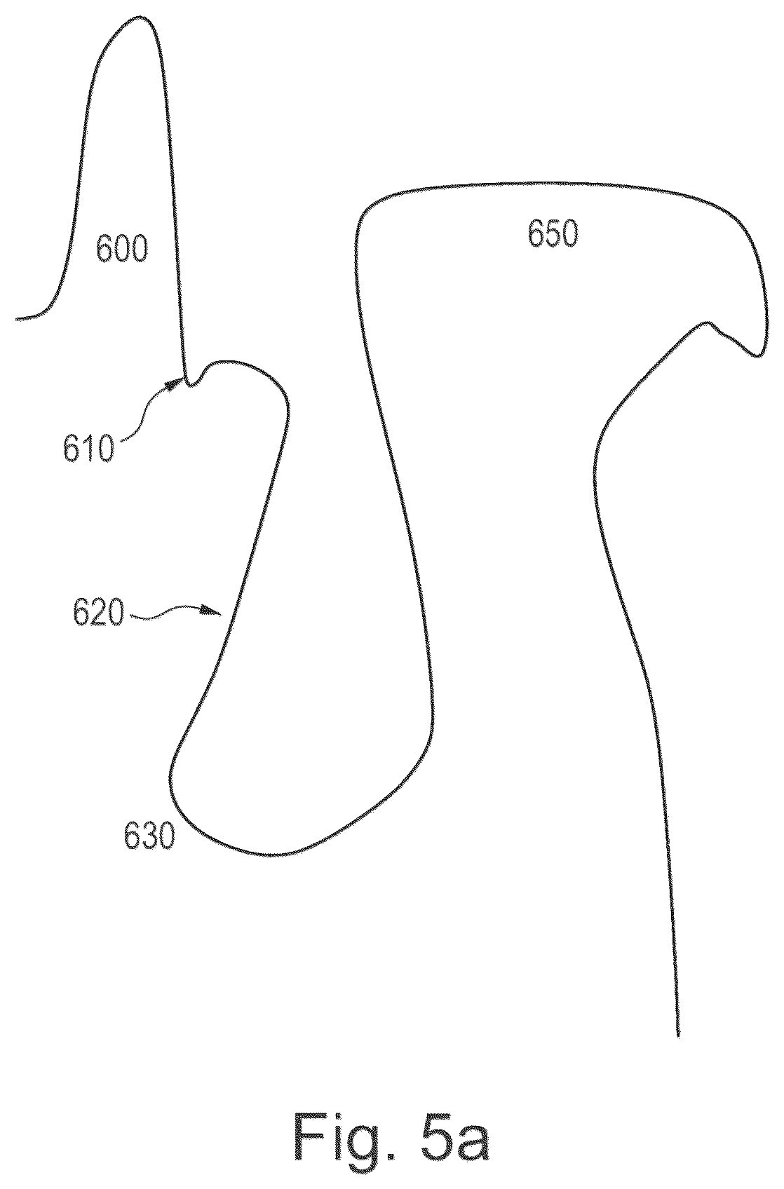 Patent US12350127 Figure 5 – Intraoral scanning with surface differentiation