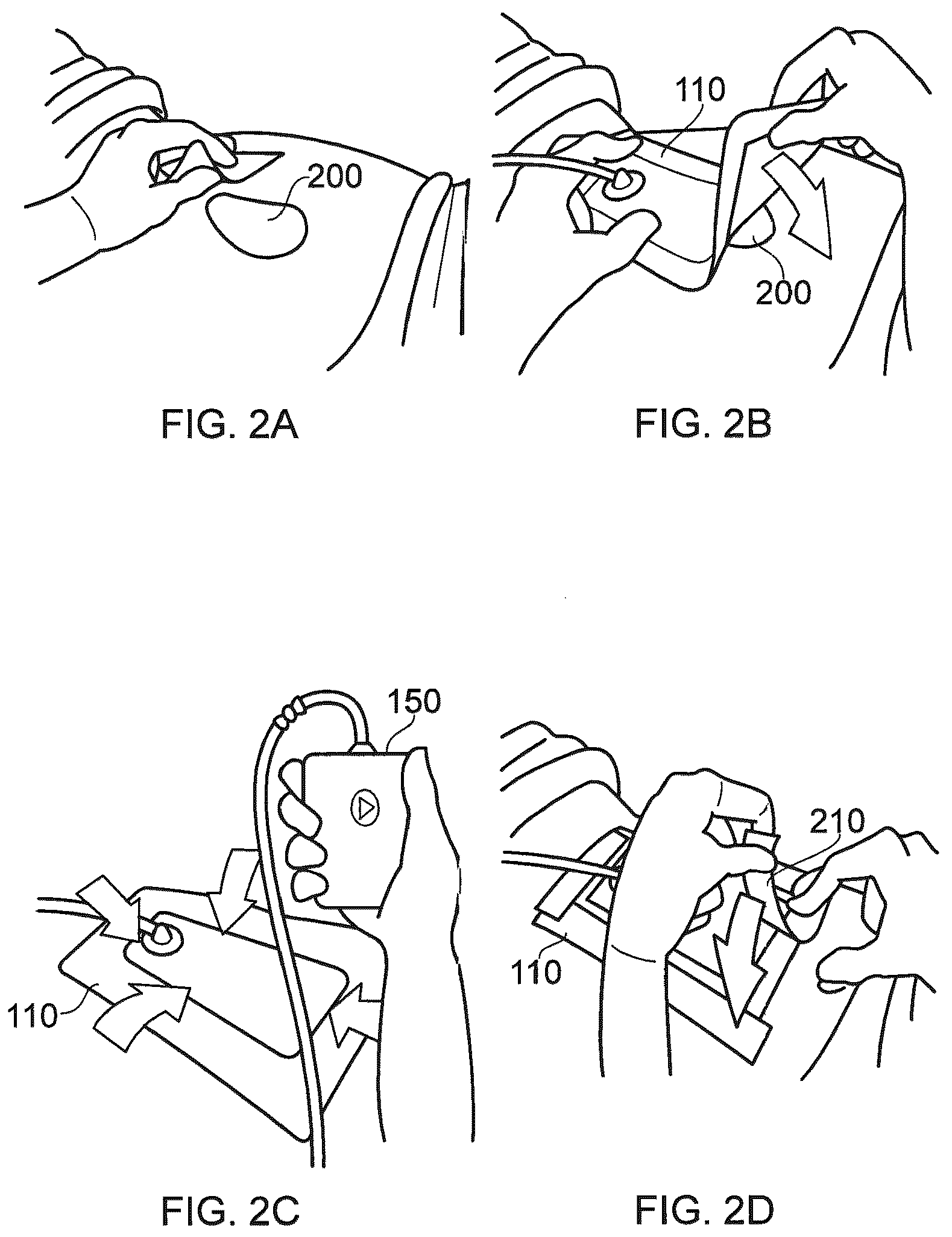 Patent US12350129 Figure 2 – Wound dressing sealant and use thereof