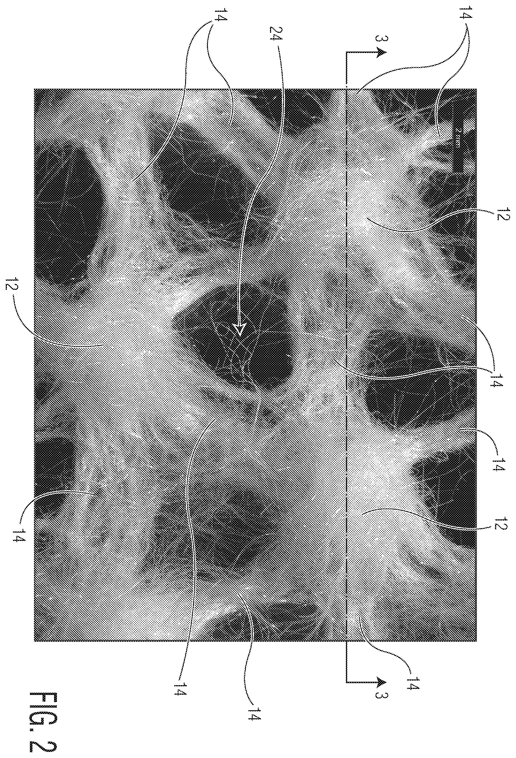 Patent US12350134 Figure 2 – Three-dimensional nonwoven materials and methods of manufacturing thereof