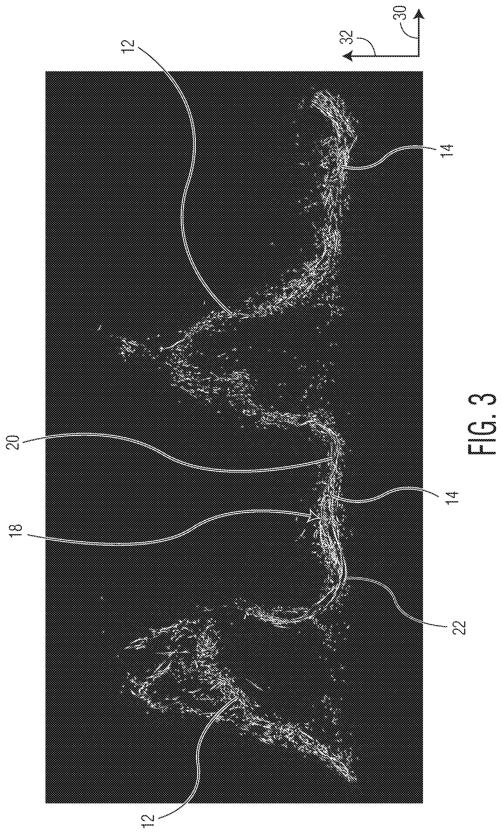 Patent US12350134 Figure 3 – Three-dimensional nonwoven materials and methods of manufacturing thereof