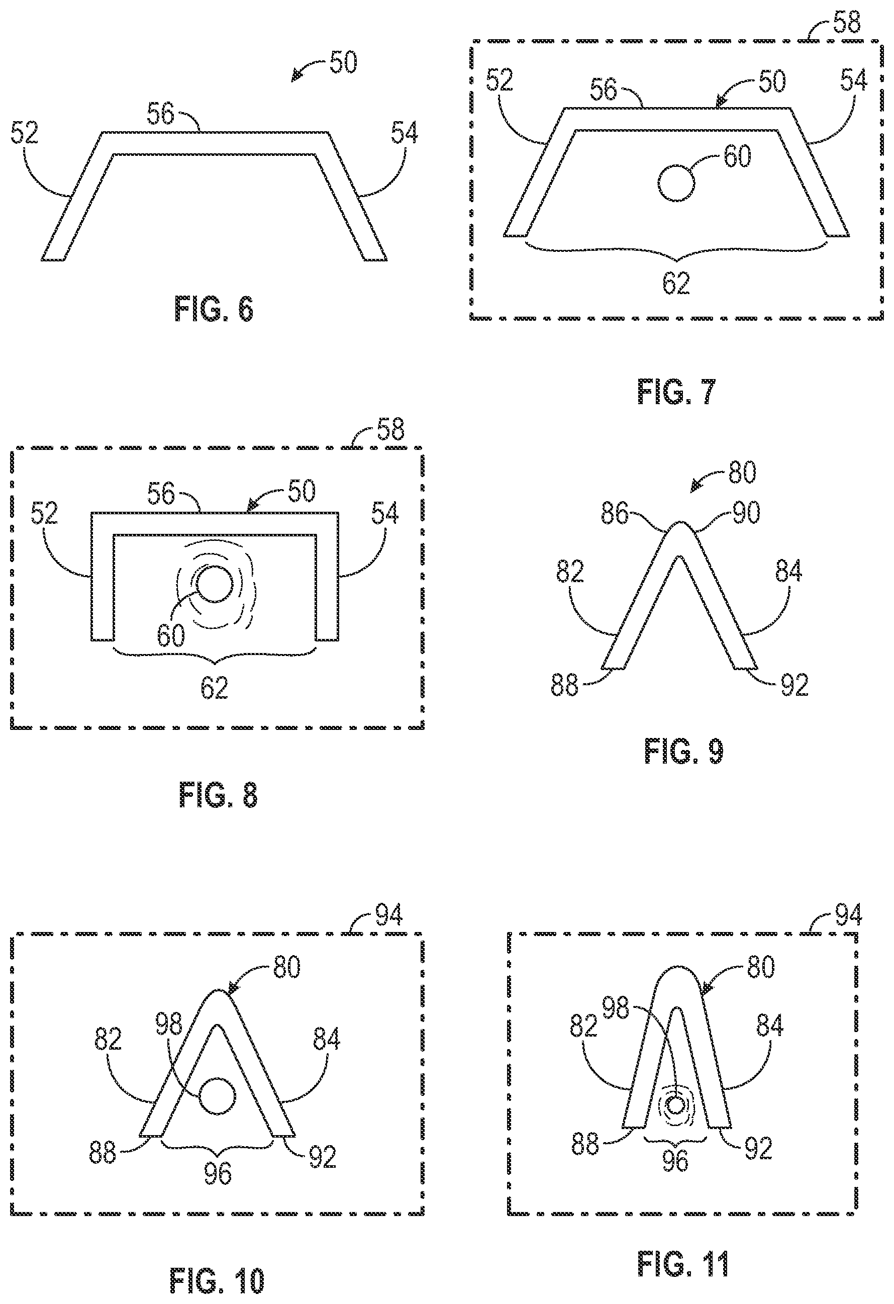 Patent US12350137 Figure 2 – Skin compression device and methods of production and use thereof