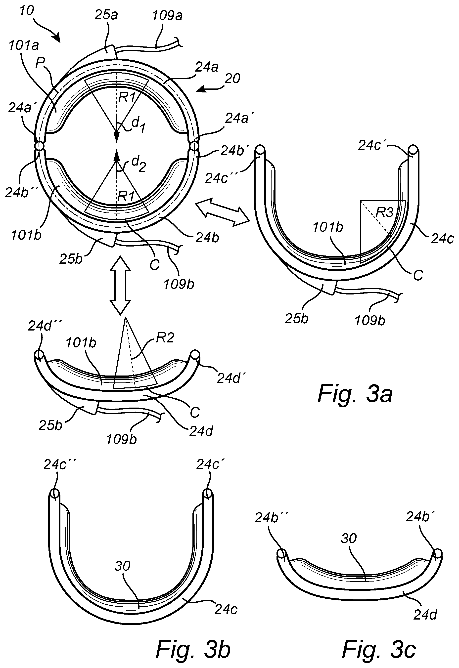 Patent US12350138 Figure 6 – Implantable urethra restriction device
