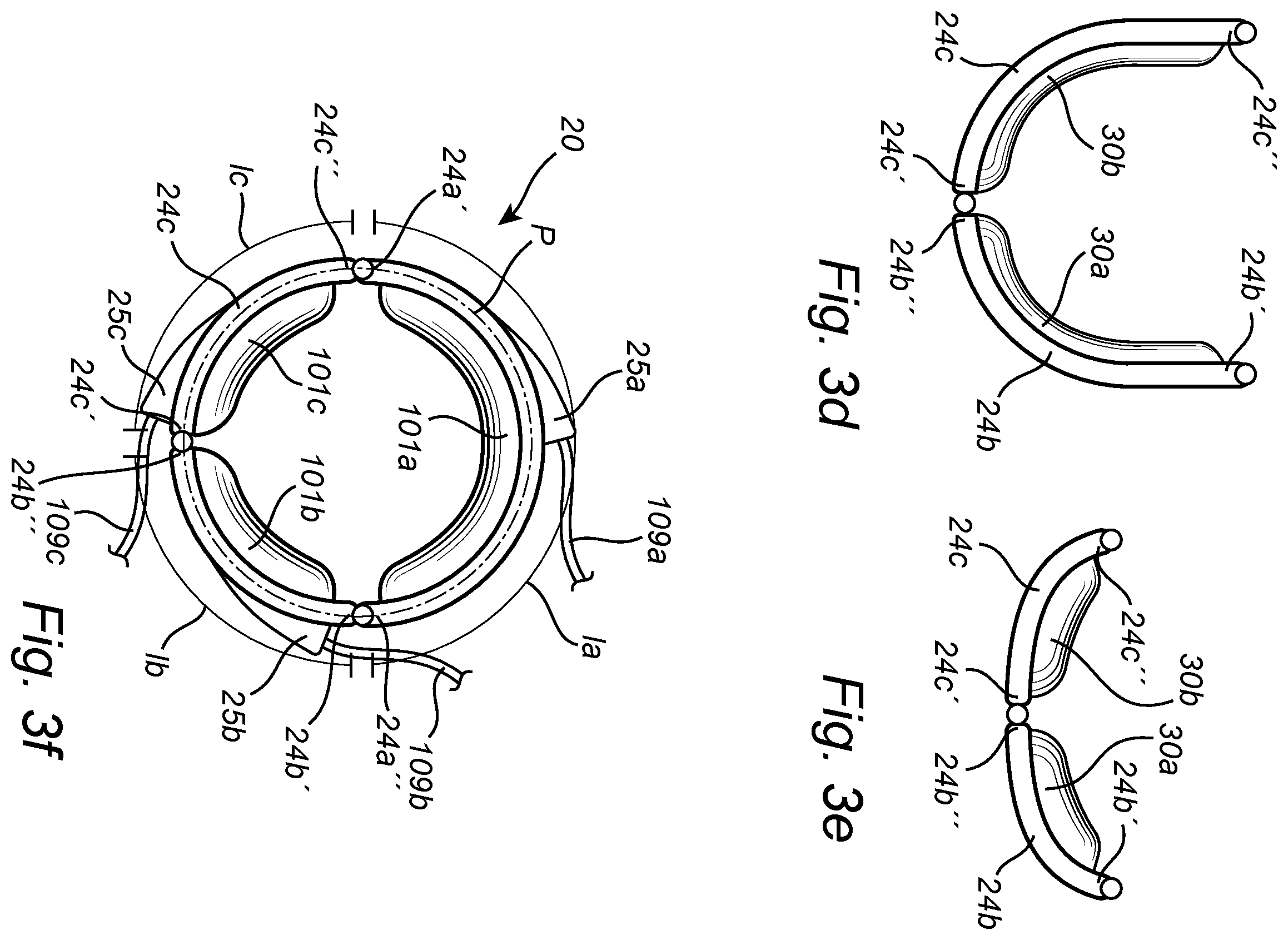 Patent US12350138 Figure 7 – Implantable urethra restriction device