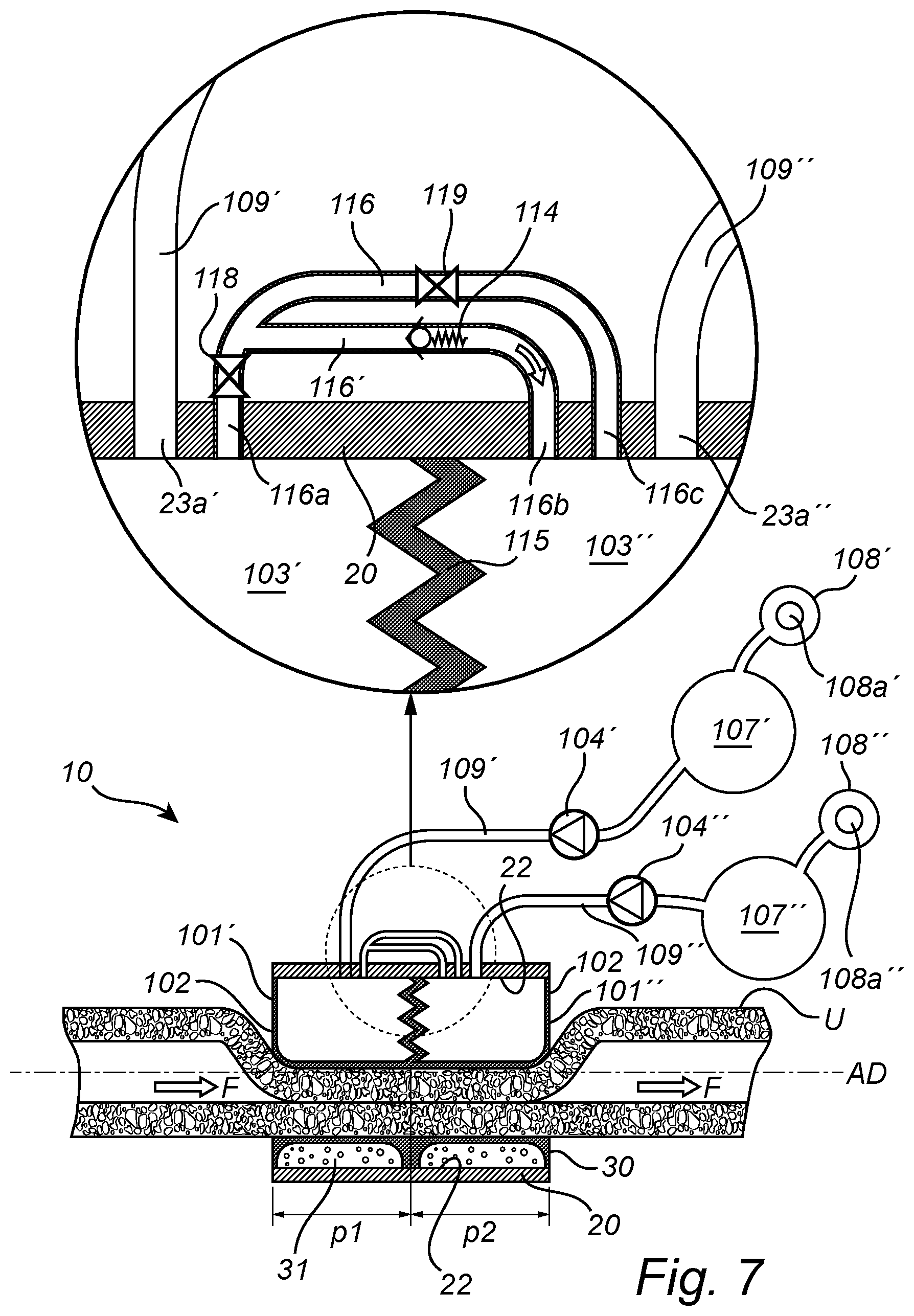 Patent US12350138 Figure 12 – Implantable urethra restriction device
