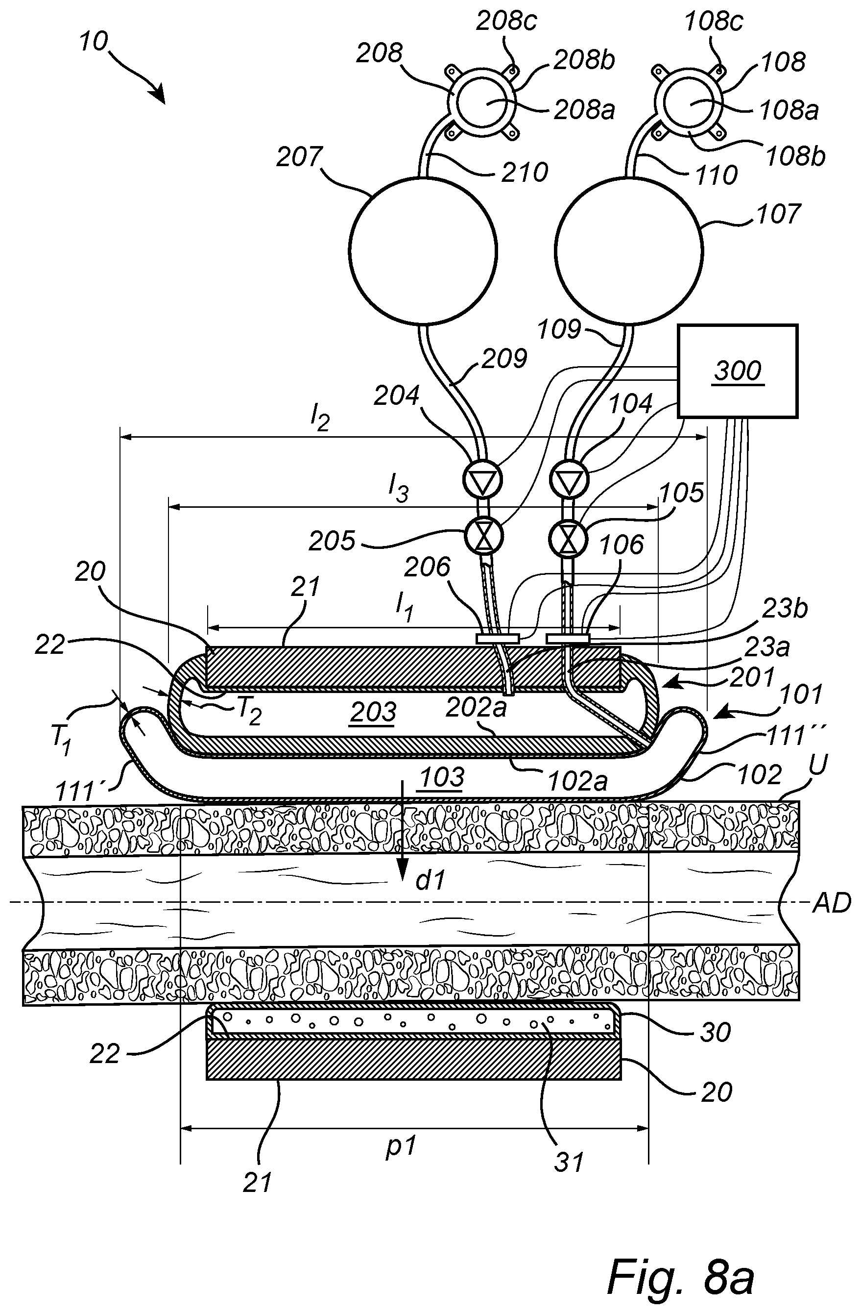 Patent US12350138 Figure 13 – Implantable urethra restriction device