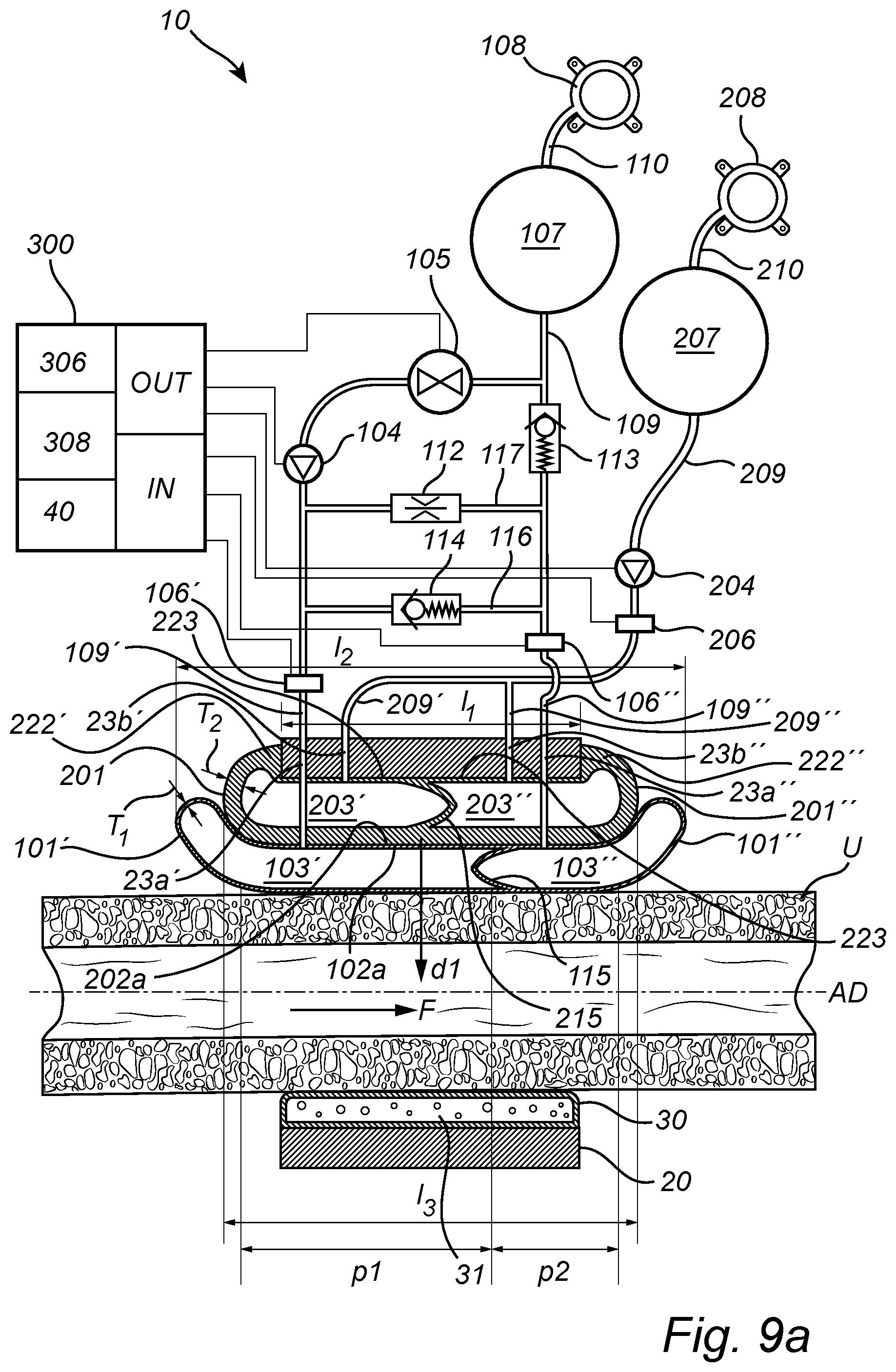 Patent US12350138 Figure 16 – Implantable urethra restriction device