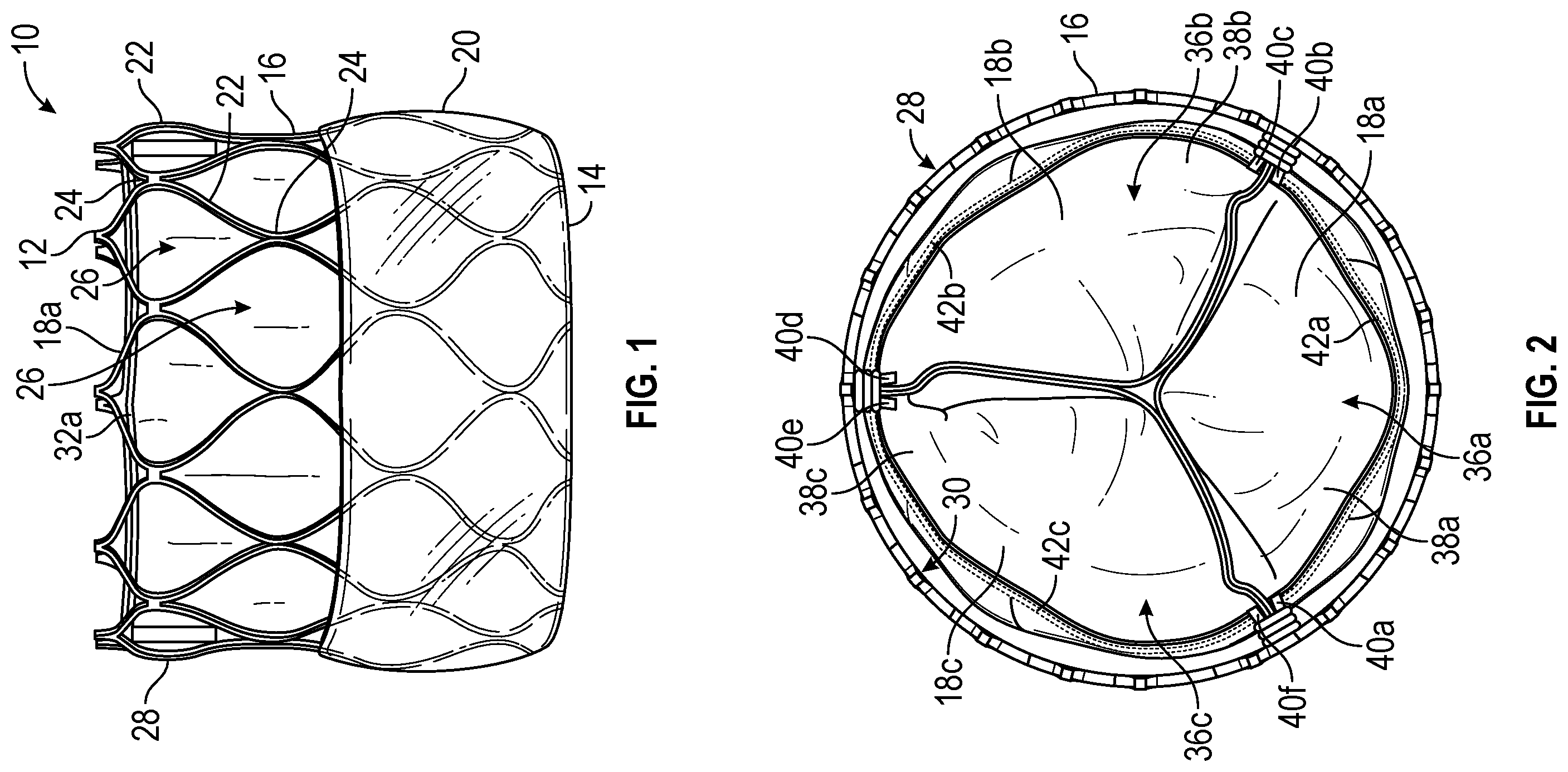 Patent US12350139 Figure 1 – Systems and methods for holding prosthetic implants