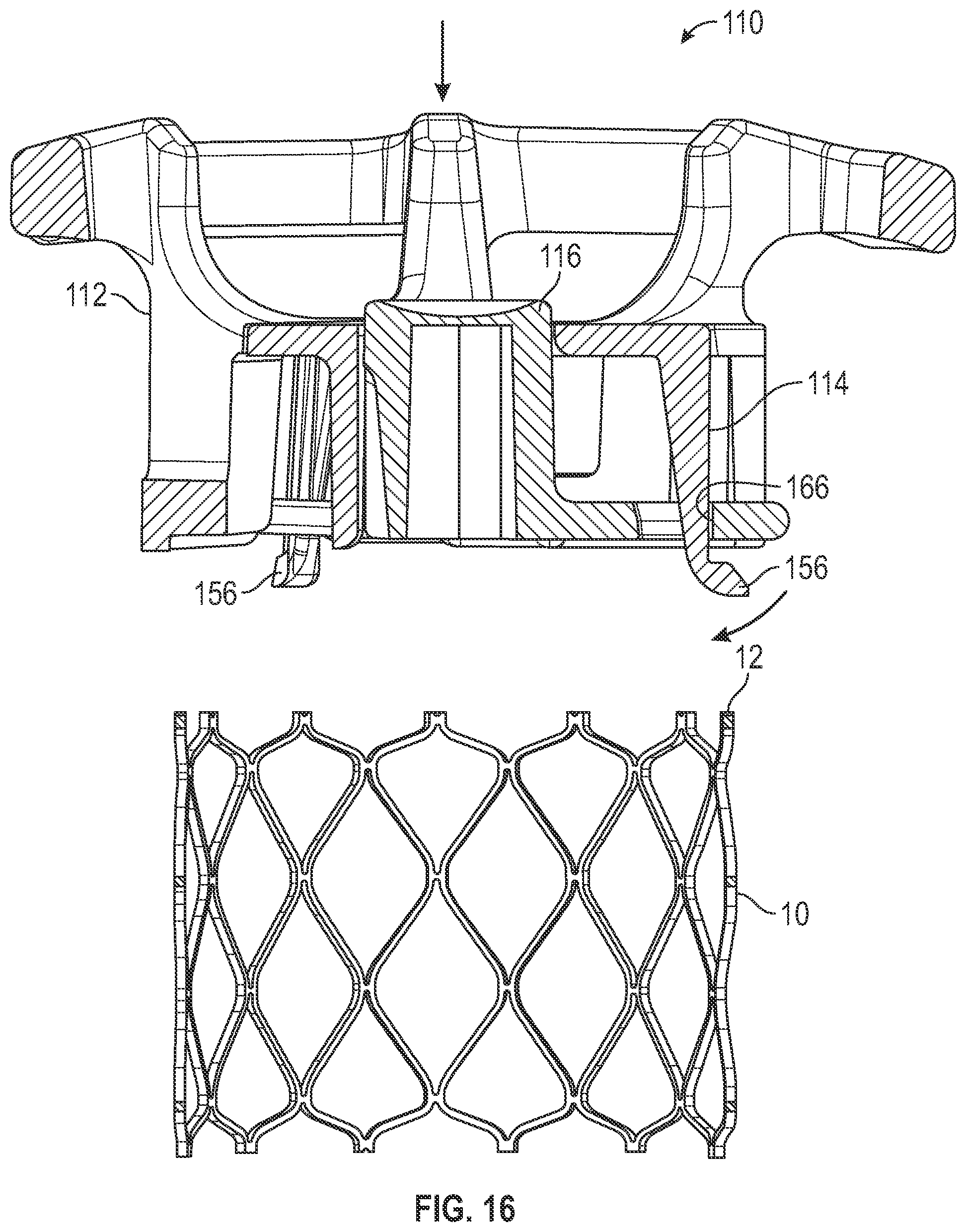 Patent US12350139 Figure 9 – Systems and methods for holding prosthetic implants