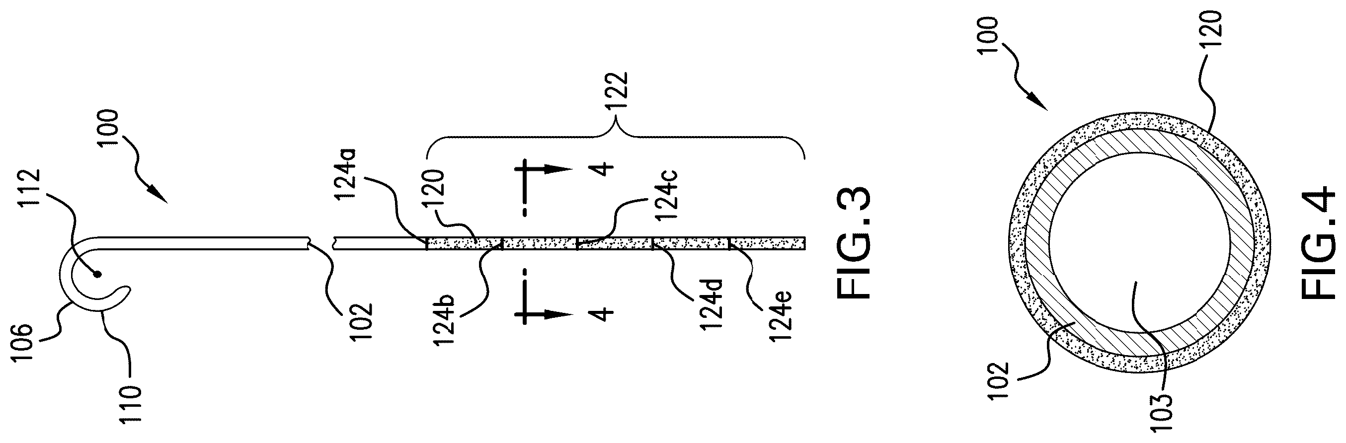 Patent US12350140 Figure 4 – Variable length stent