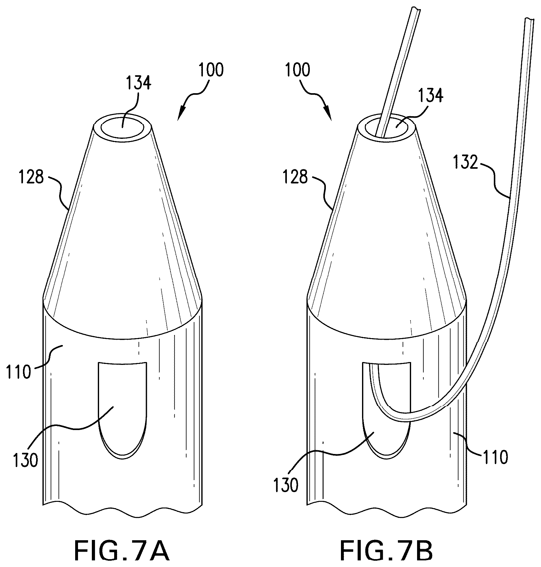 Patent US12350140 Figure 8 – Variable length stent