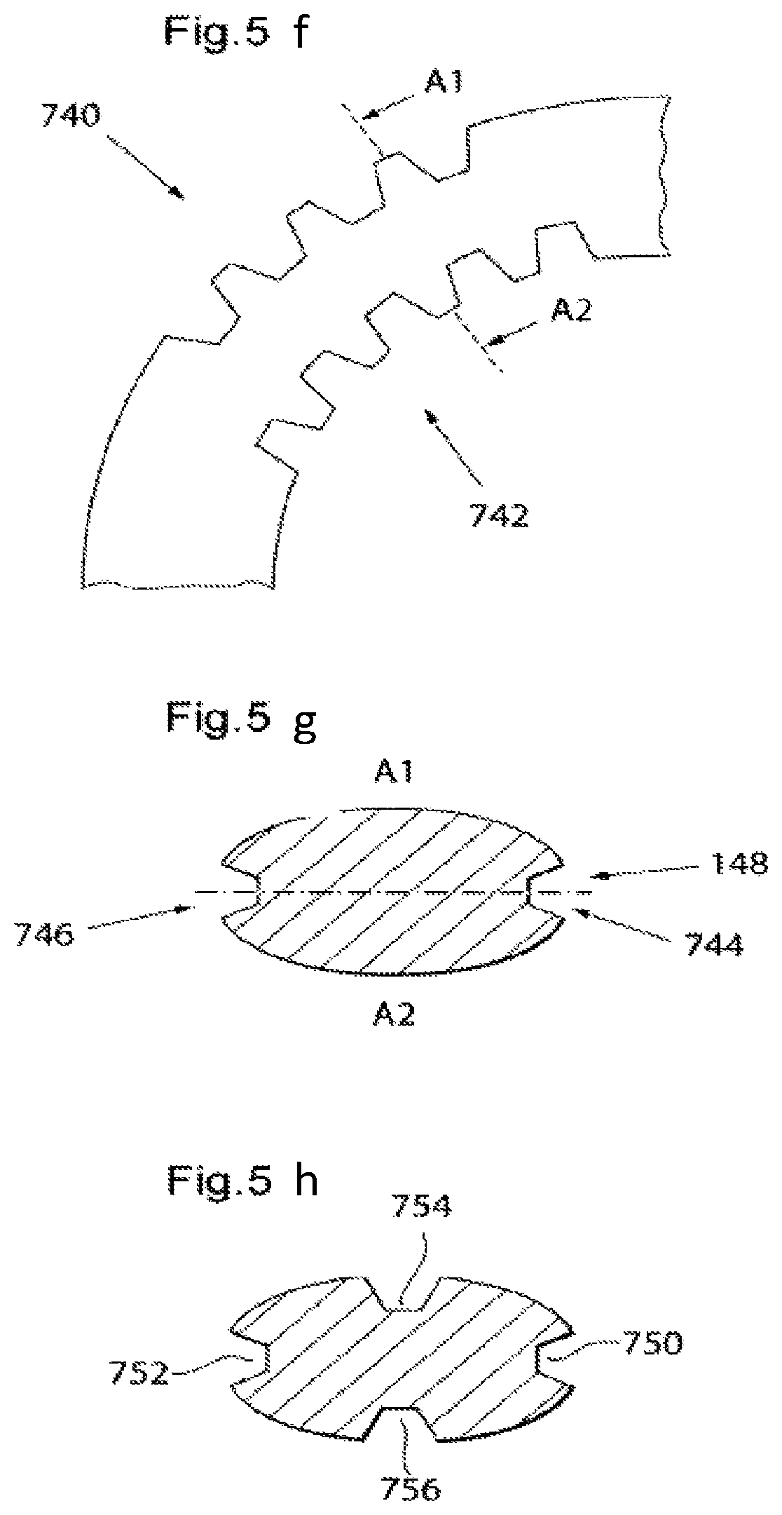 Patent US12350141 Figure 7 – Method and instrument for treating obesity