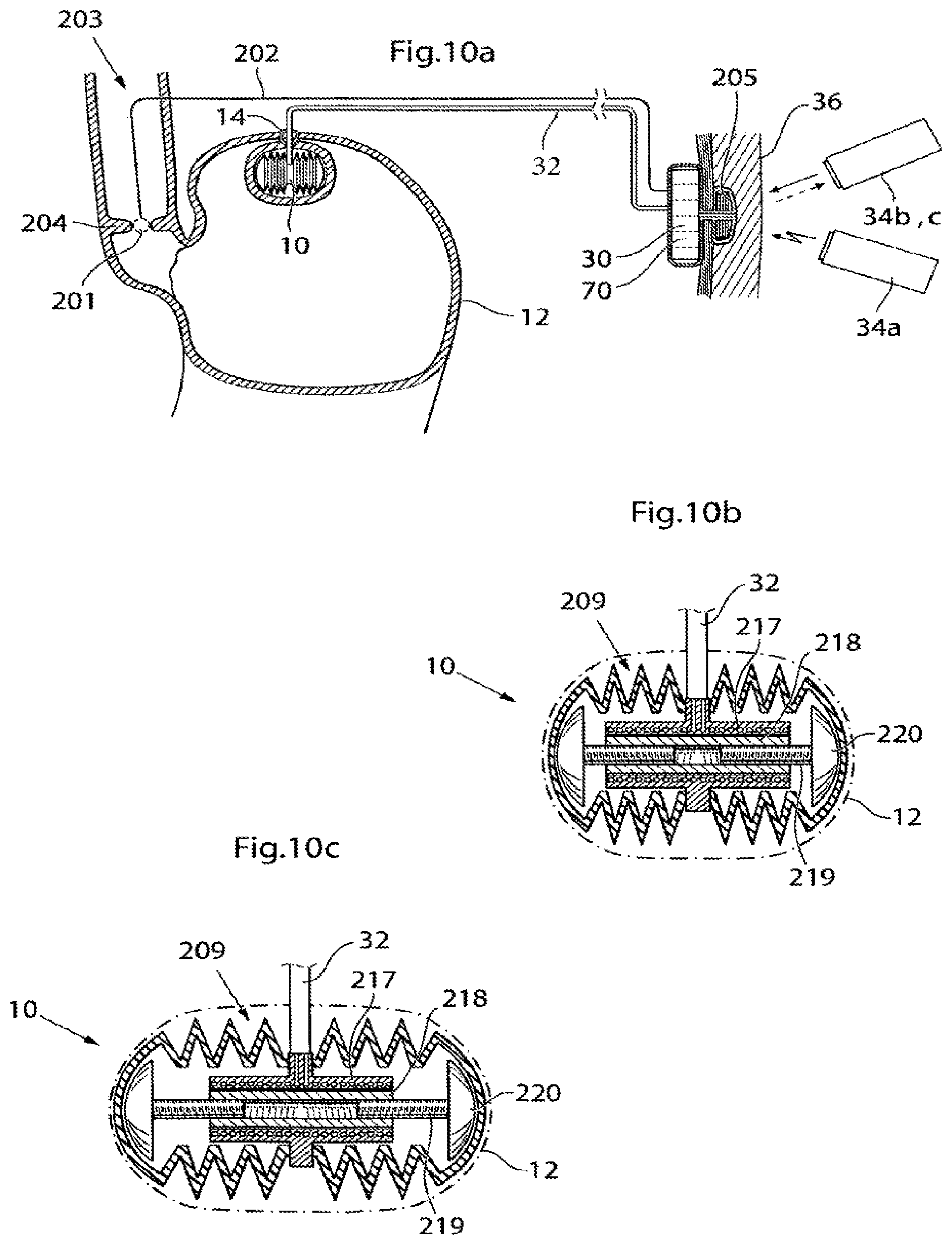 Patent US12350141 Figure 12 – Method and instrument for treating obesity