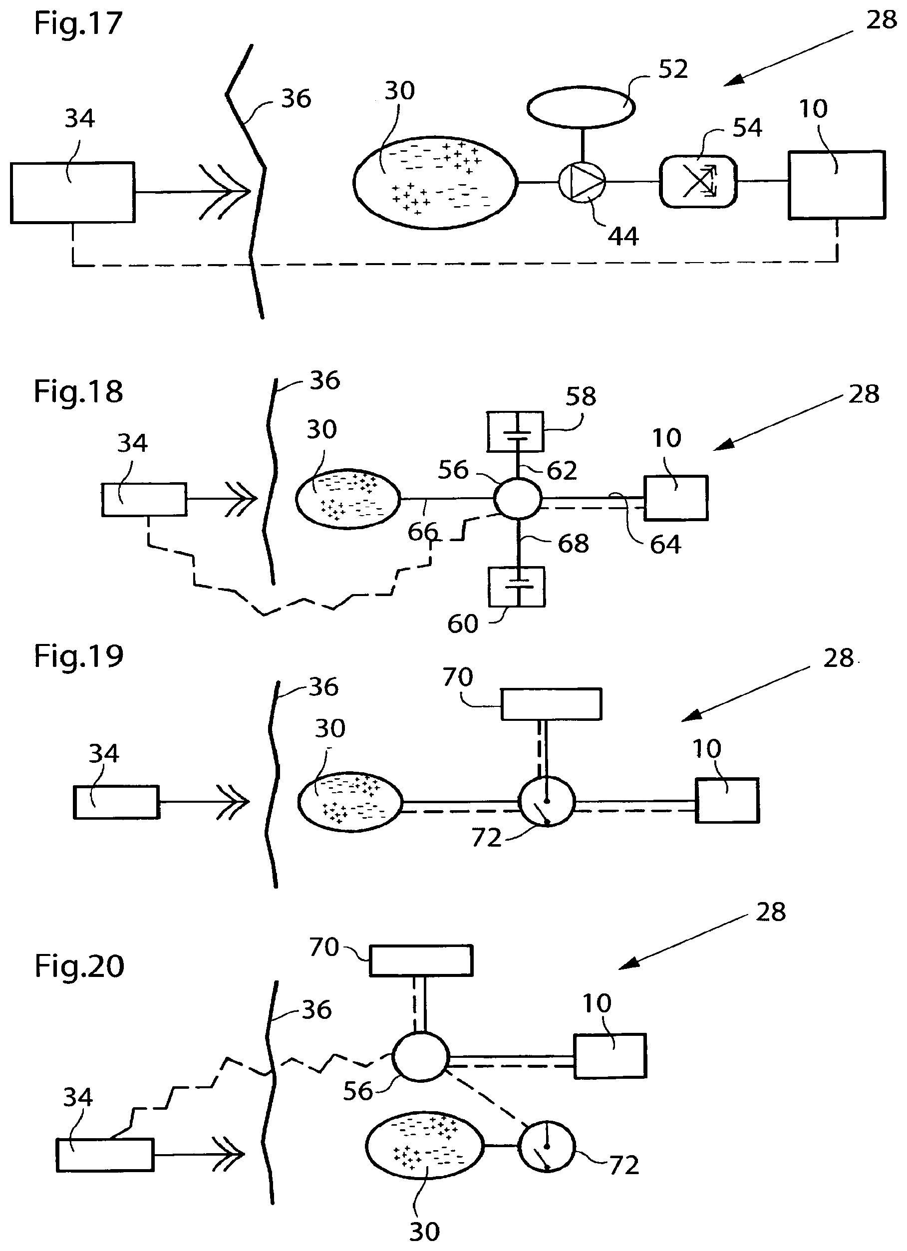 Patent US12350141 Figure 17 – Method and instrument for treating obesity