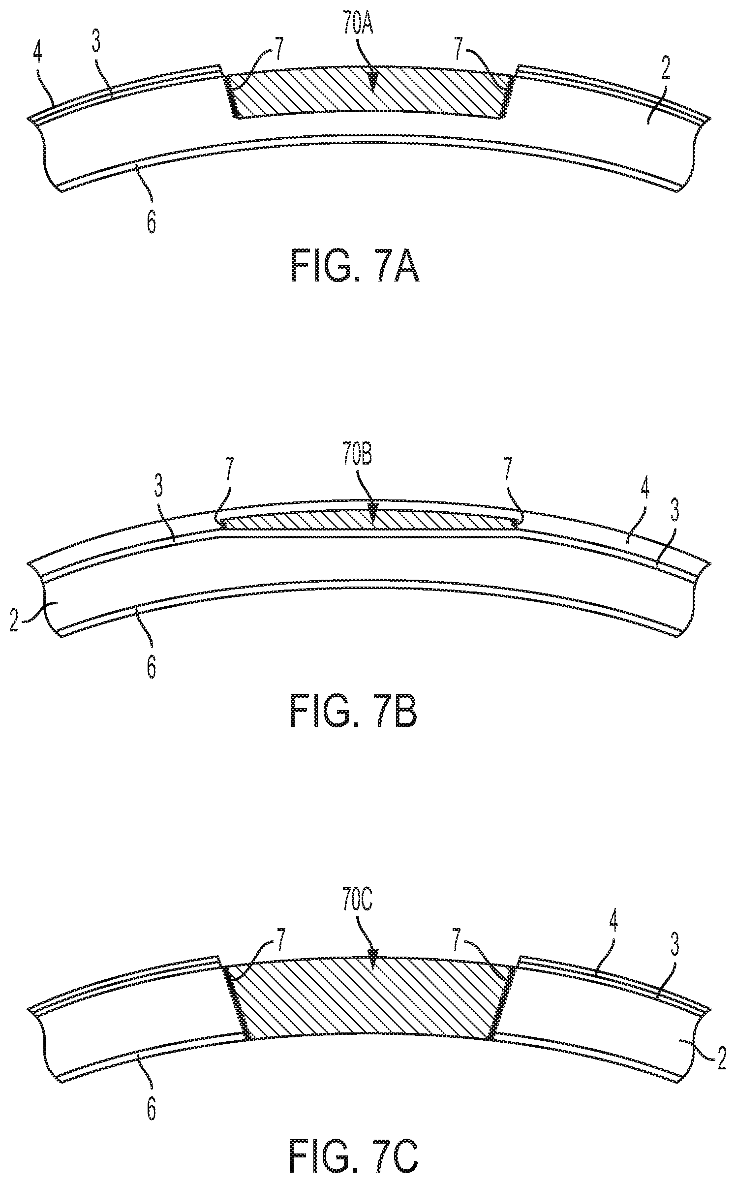 Patent US12350144 Figure 7 – Stabilization of collagen scaffolds