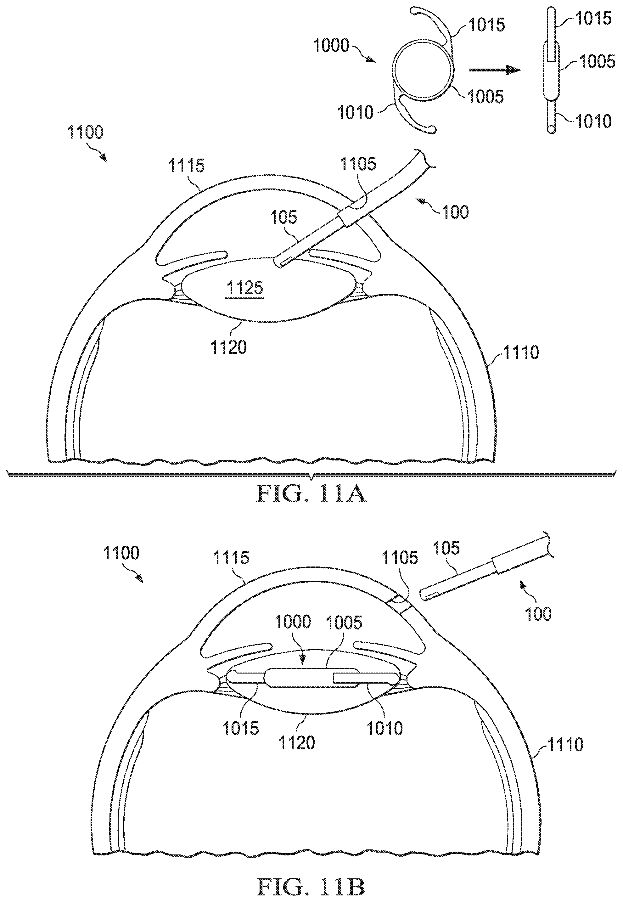 Patent US12350145 Figure 9 – Magnetically coupled power delivery for surgical implants
