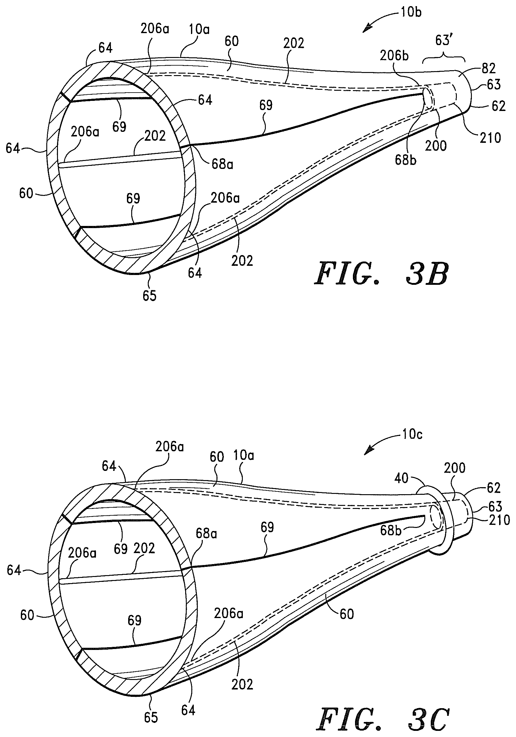 Patent US12350147 Figure 7 – Adaptable prosthetic tissue valves
