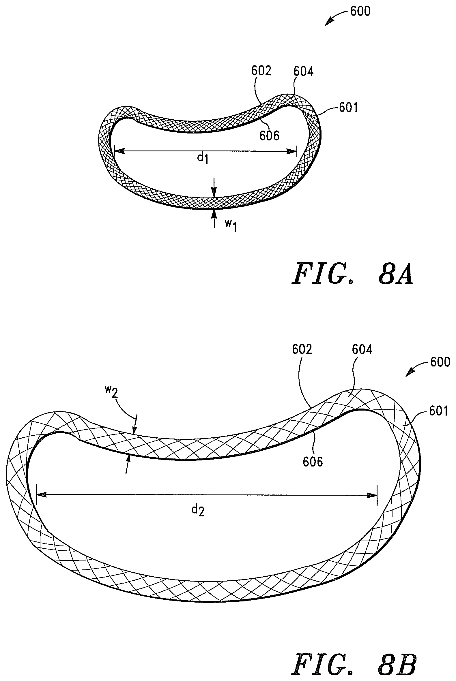 Patent US12350147 Figure 16 – Adaptable prosthetic tissue valves