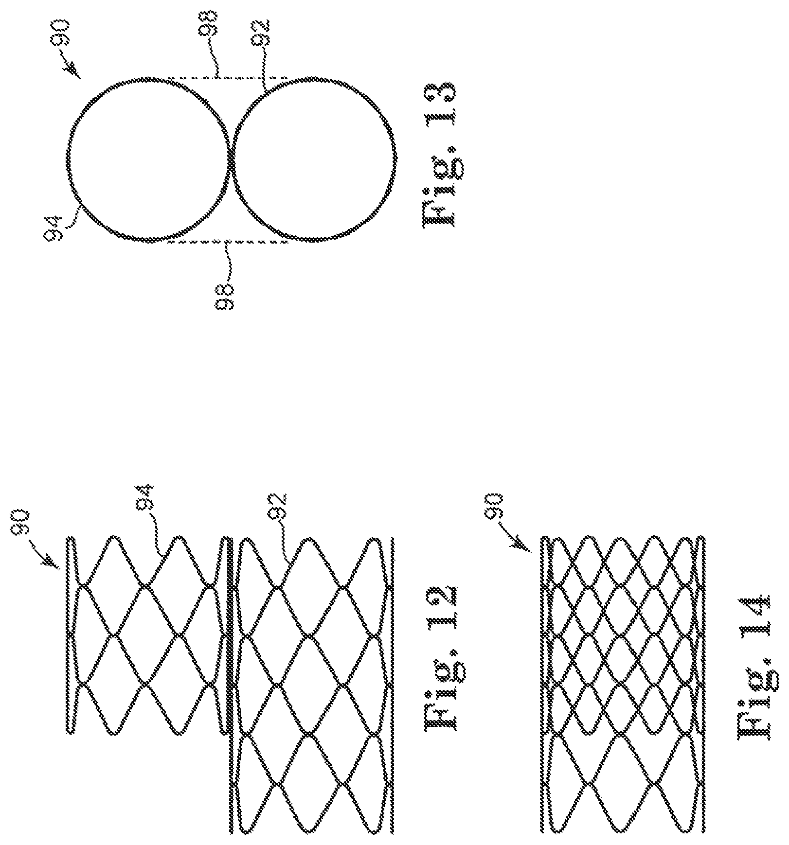 Patent US12350148 Figure 3 – Stented heart valve devices and methods for atrioventricular valve replacement