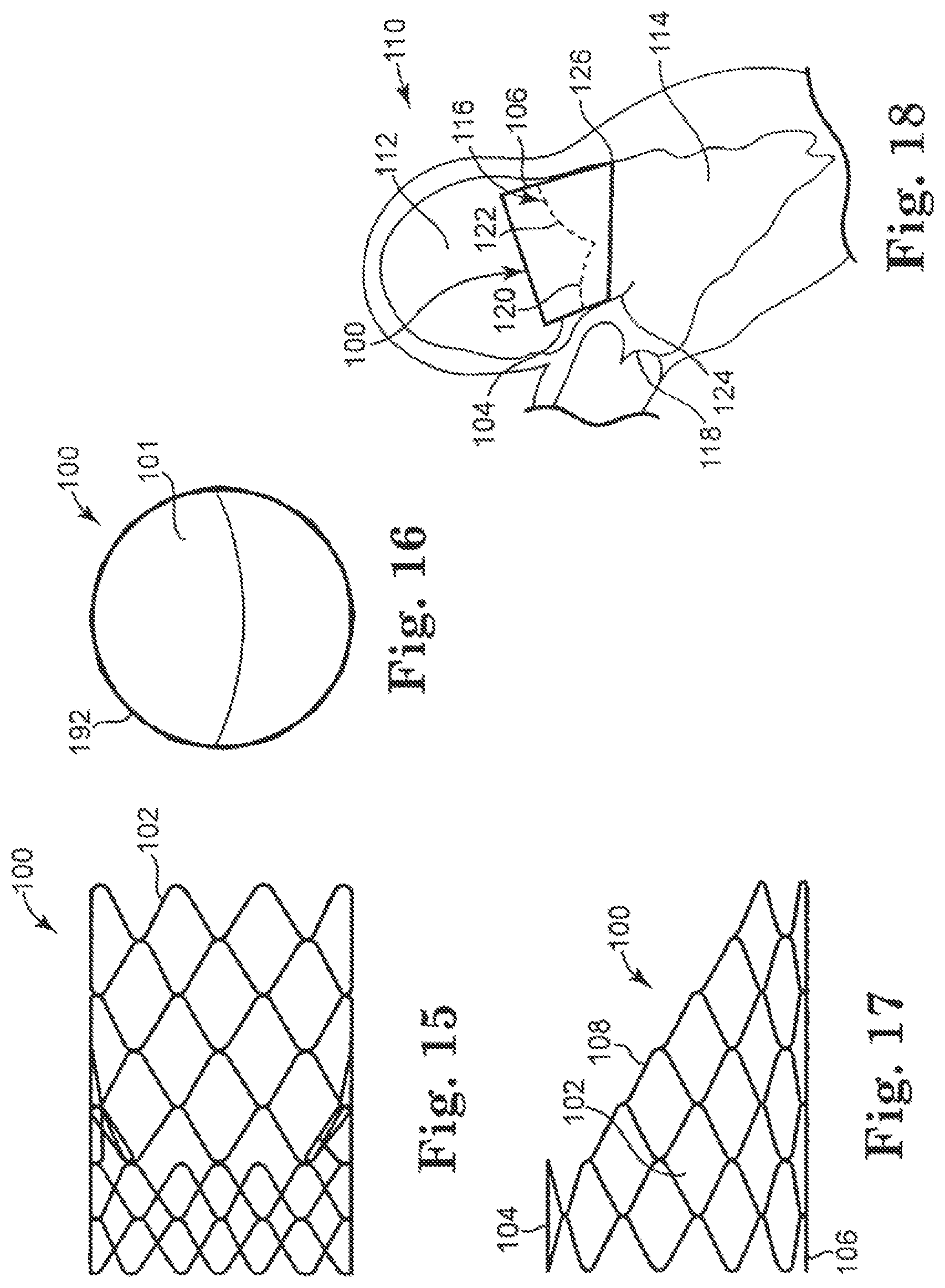 Patent US12350148 Figure 4 – Stented heart valve devices and methods for atrioventricular valve replacement
