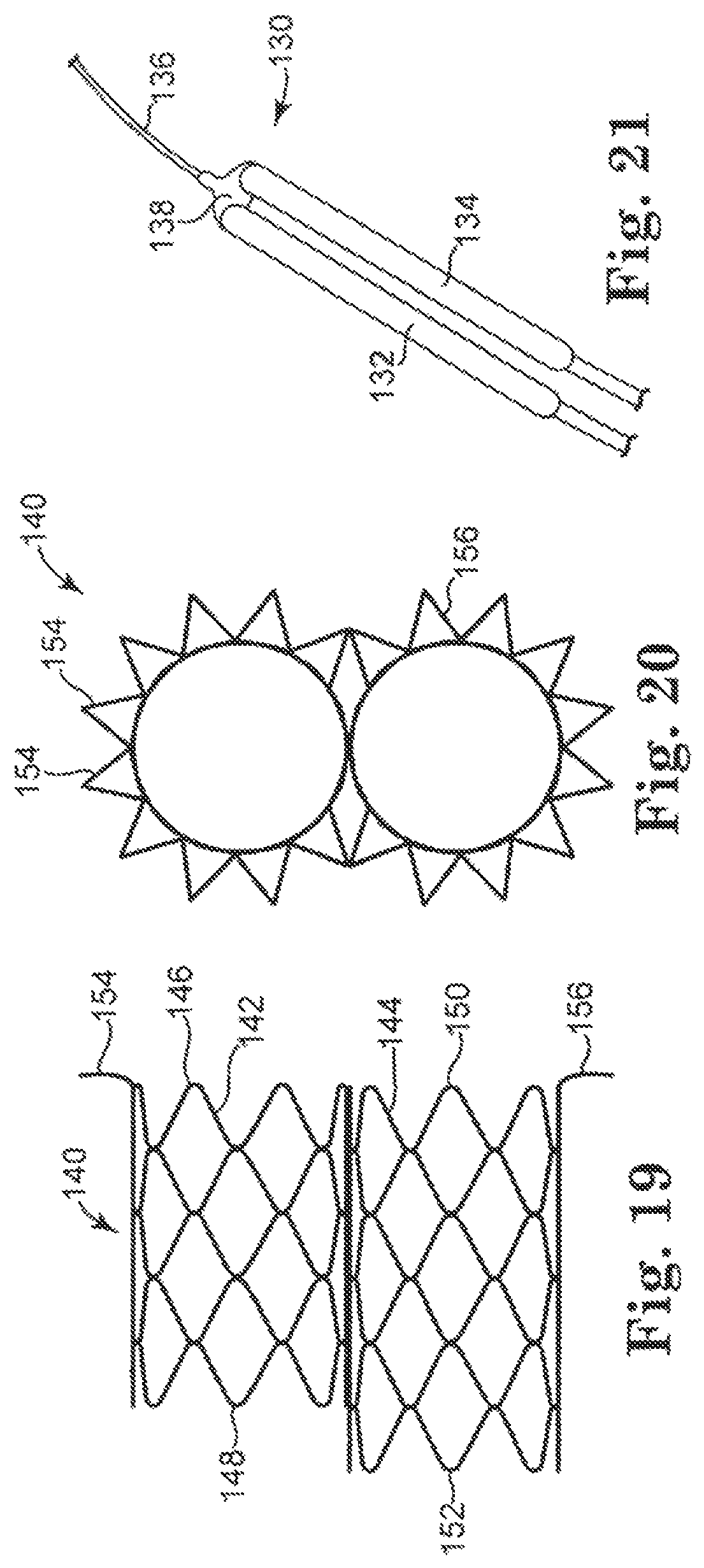 Patent US12350148 Figure 5 – Stented heart valve devices and methods for atrioventricular valve replacement
