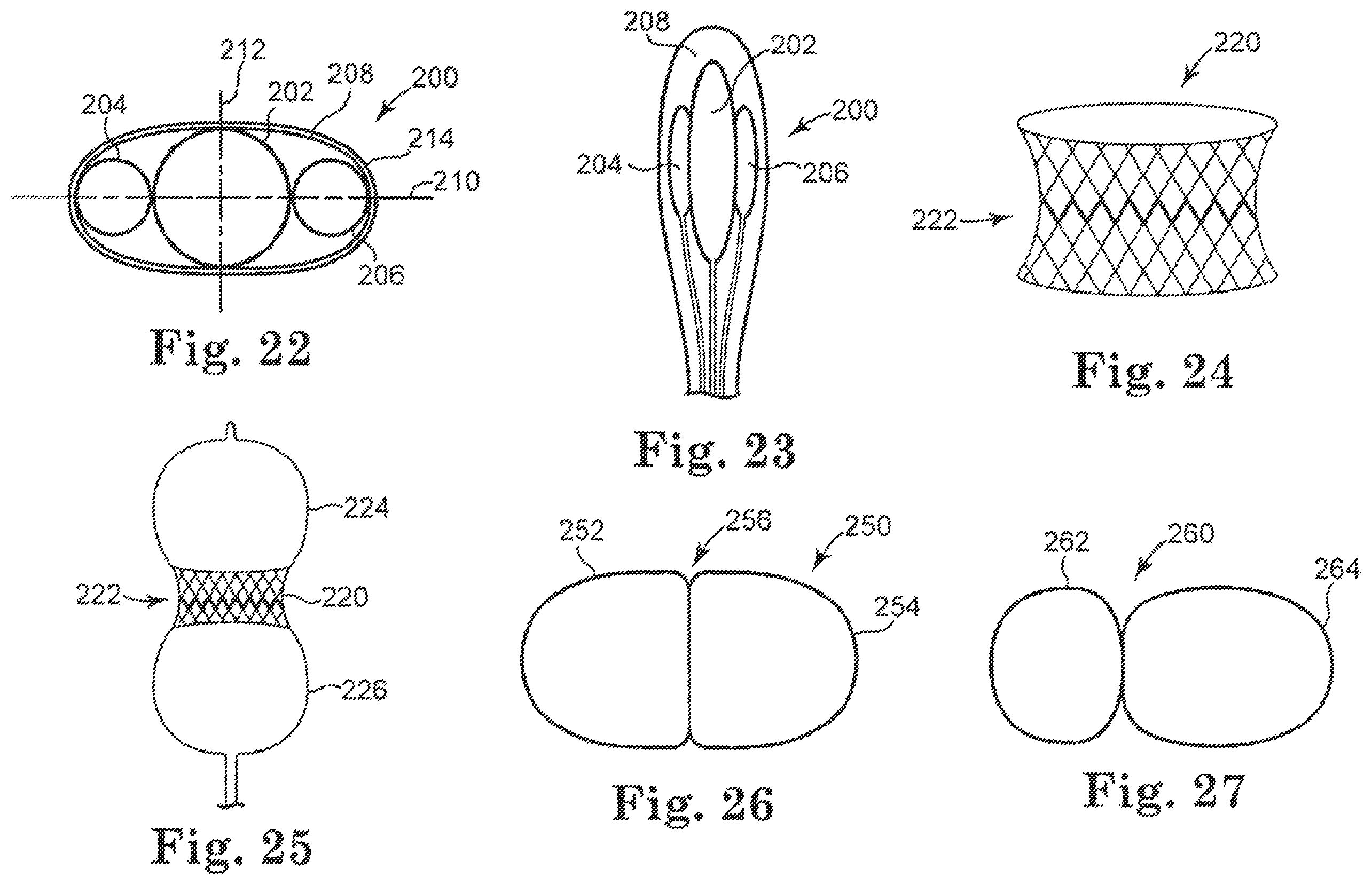 Patent US12350148 Figure 6 – Stented heart valve devices and methods for atrioventricular valve replacement
