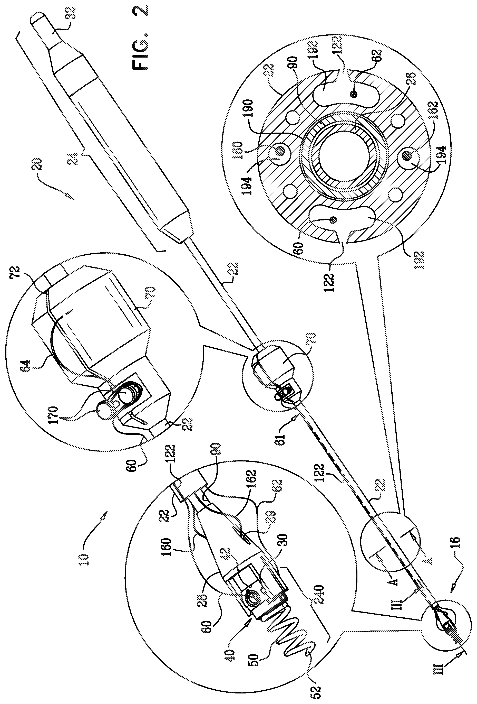 Patent US12350149 Figure 2 – Method and apparatus for repairing a heart valve