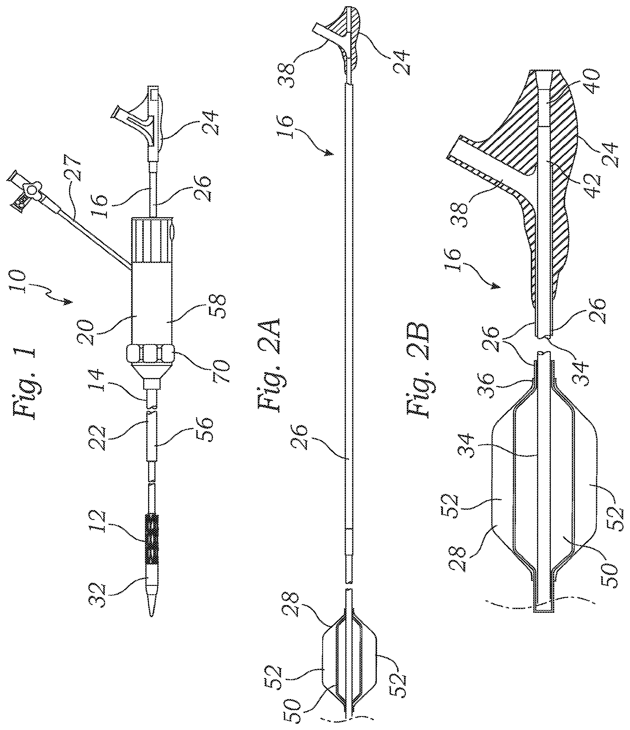 Patent US12350150 Figure 1 – Stability device for use with percutaneous delivery systems