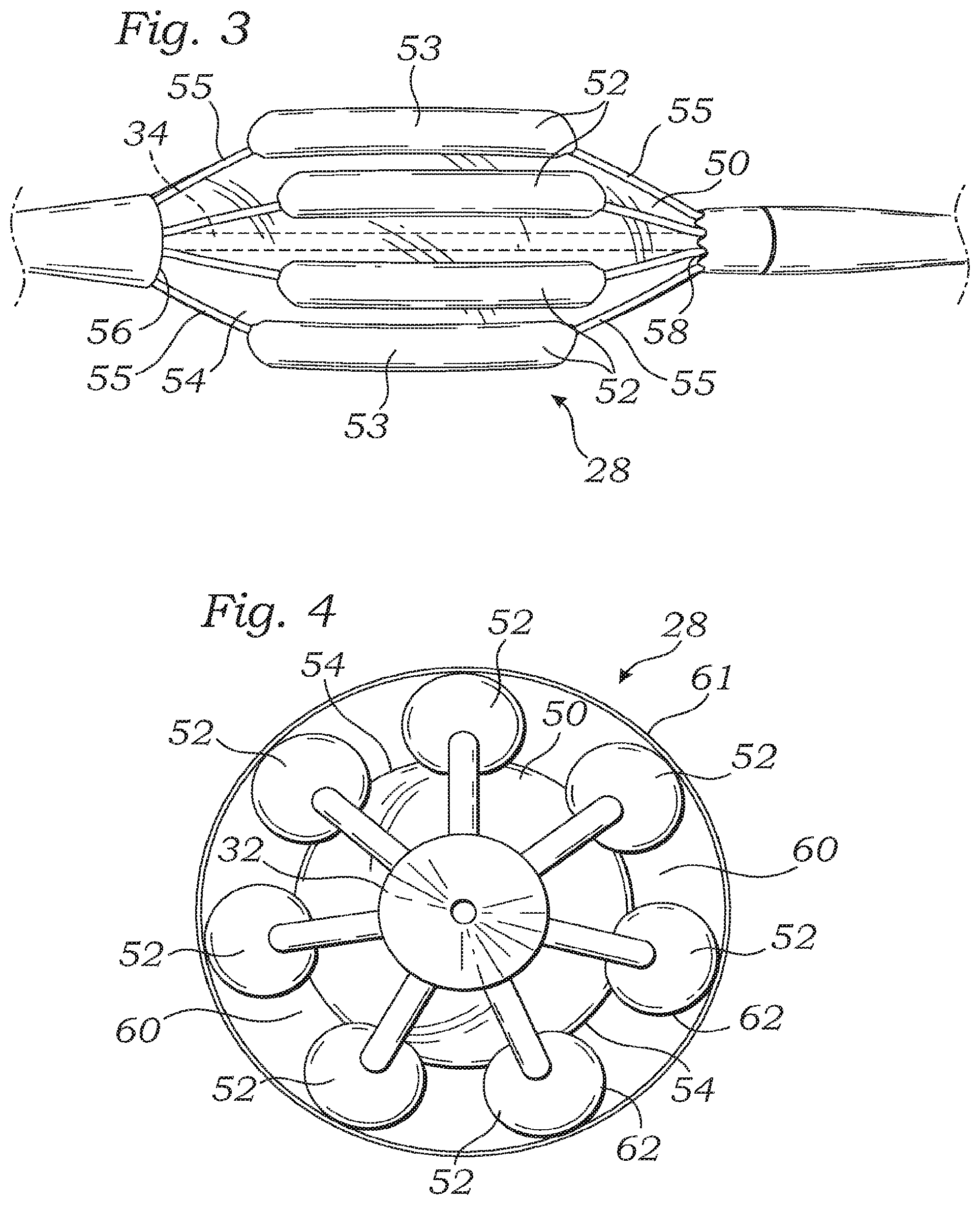 Patent US12350150 Figure 2 – Stability device for use with percutaneous delivery systems