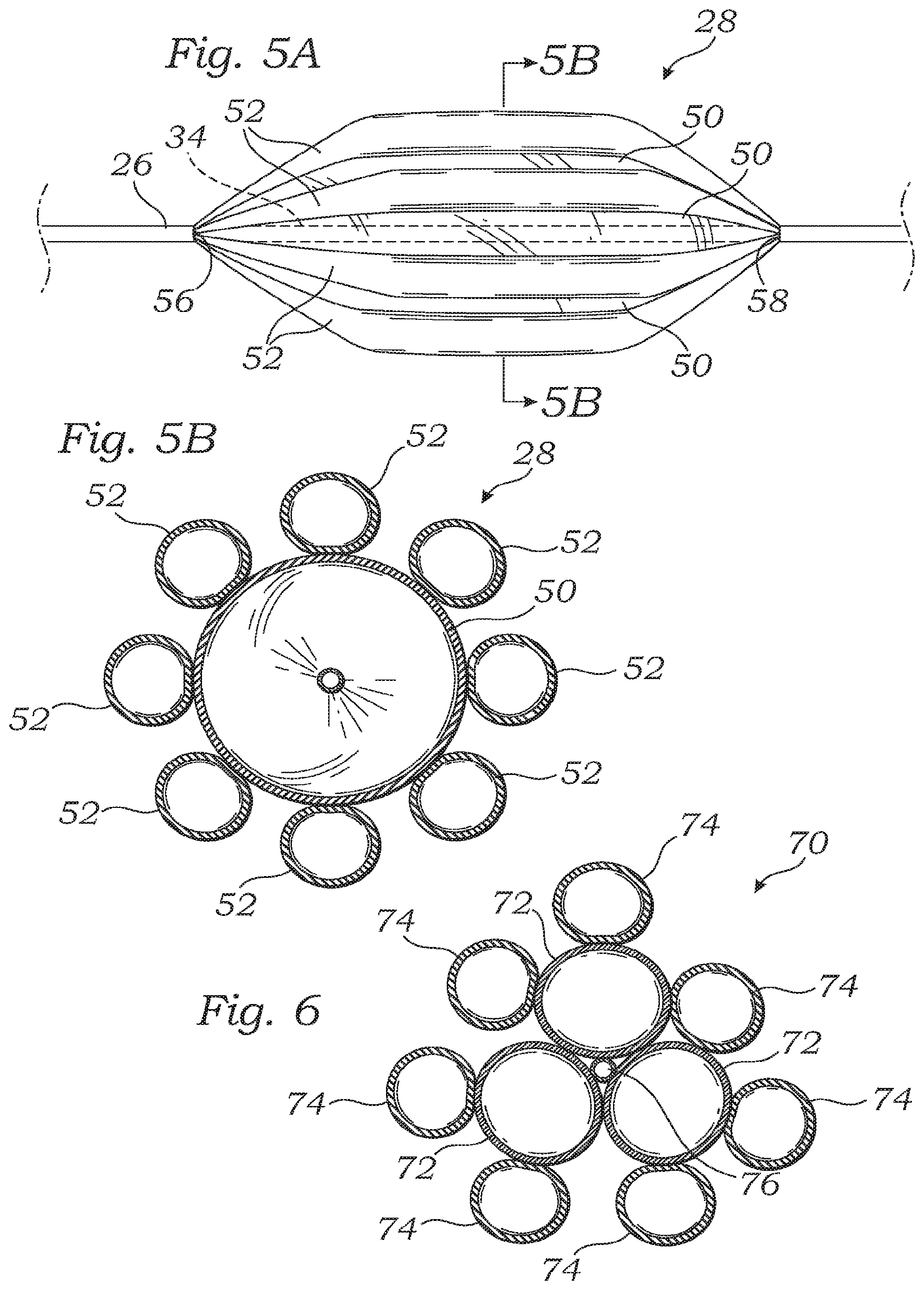 Patent US12350150 Figure 3 – Stability device for use with percutaneous delivery systems