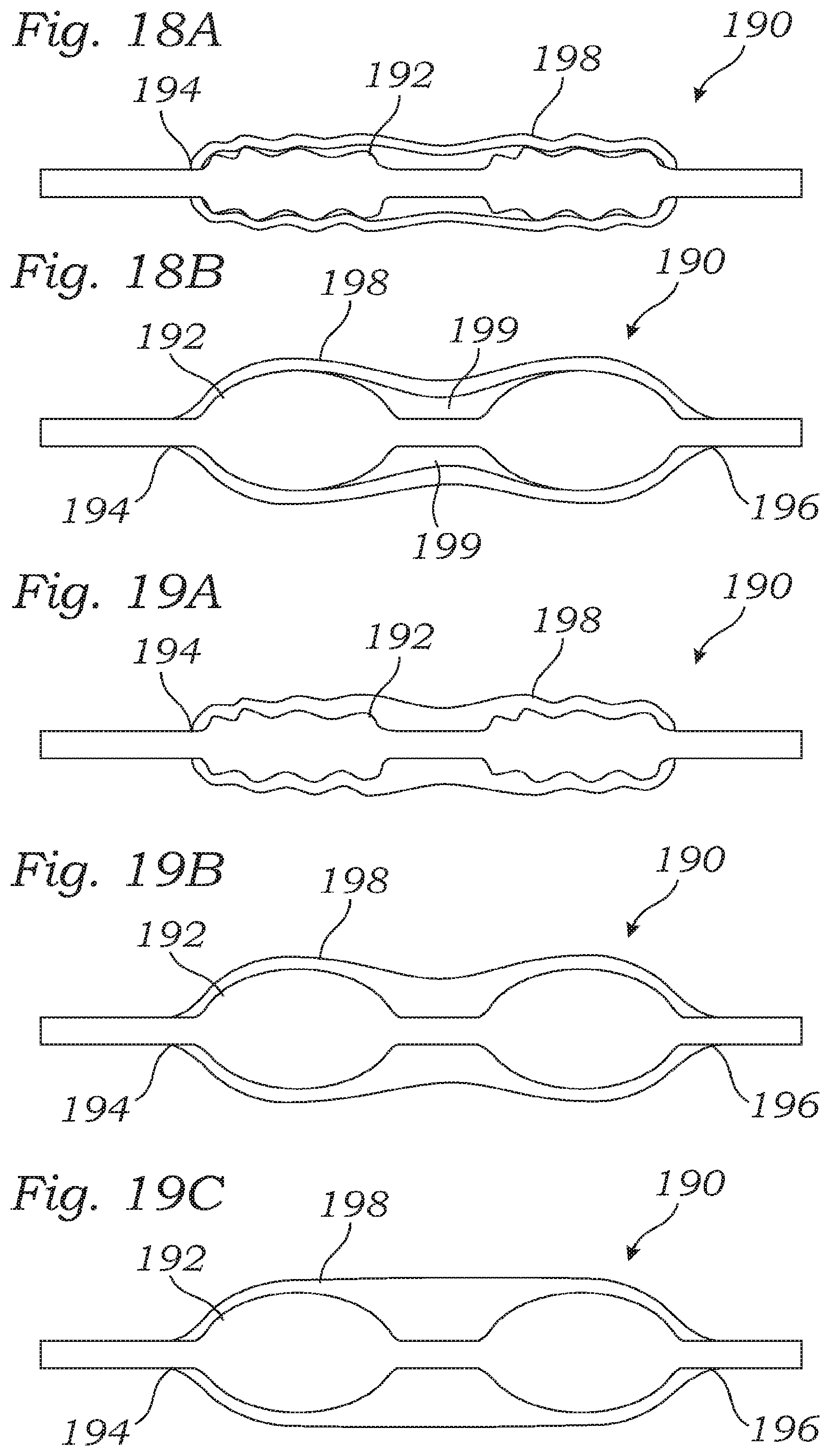 Patent US12350150 Figure 9 – Stability device for use with percutaneous delivery systems