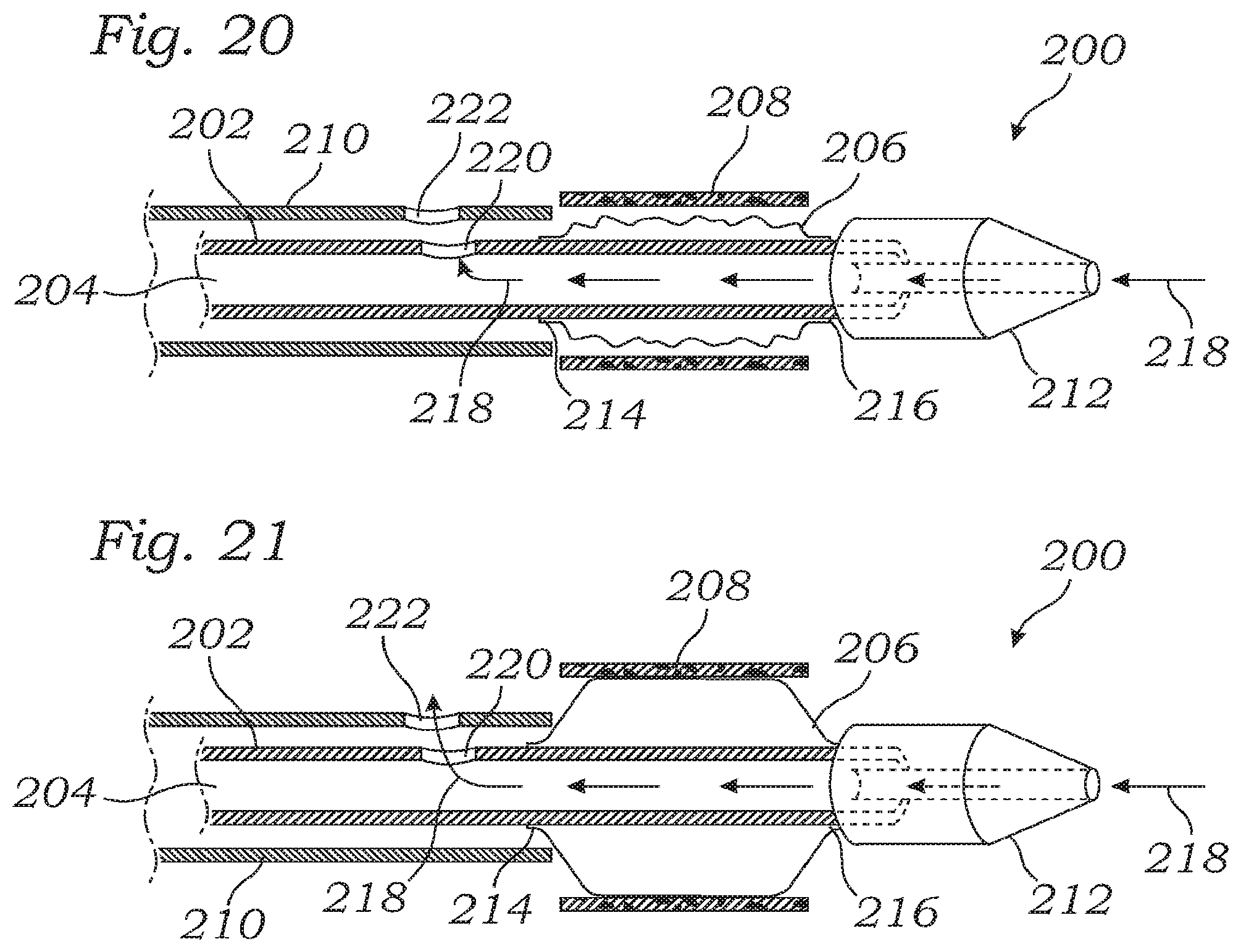 Patent US12350150 Figure 10 – Stability device for use with percutaneous delivery systems