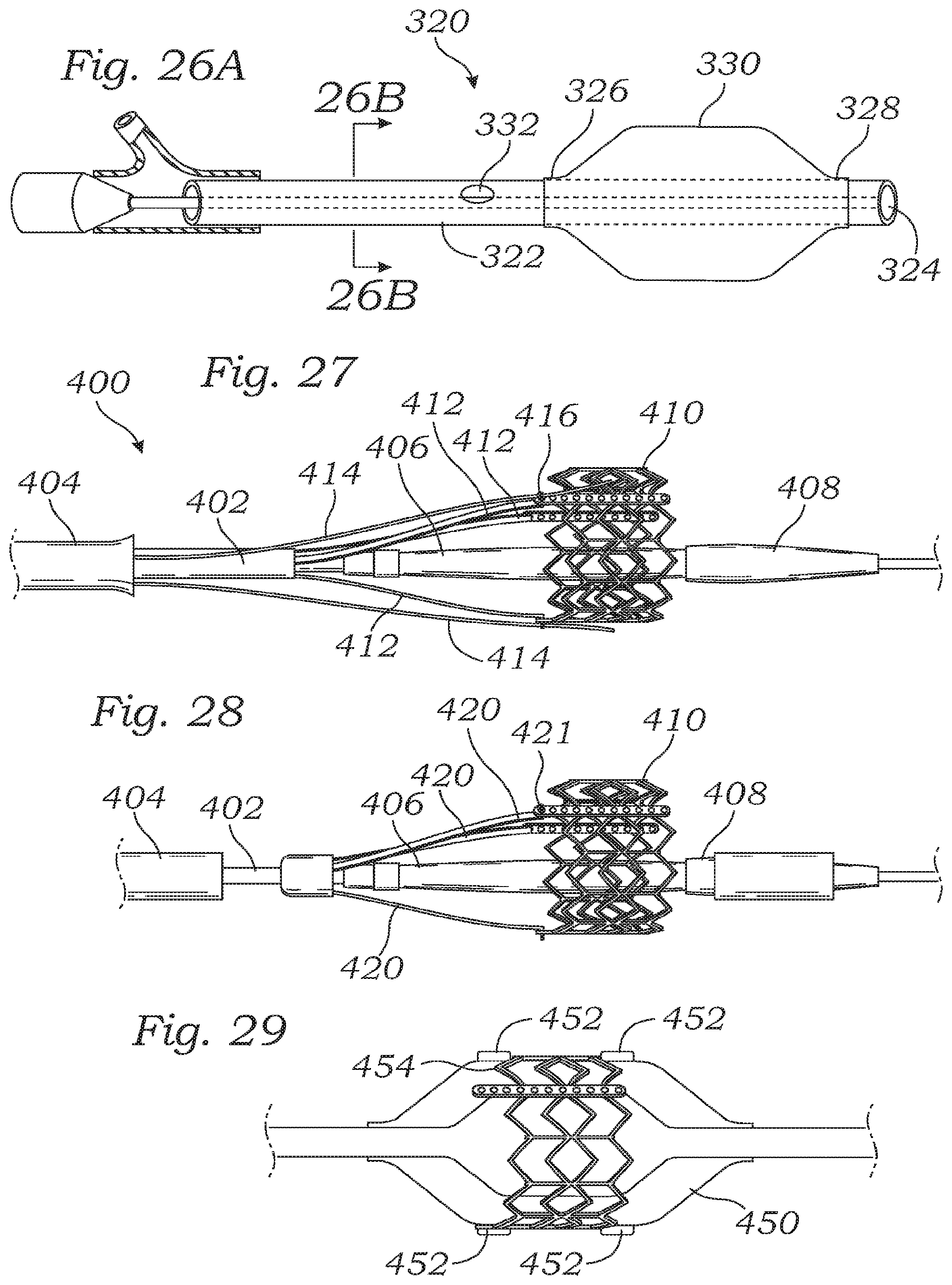 Patent US12350150 Figure 12 – Stability device for use with percutaneous delivery systems