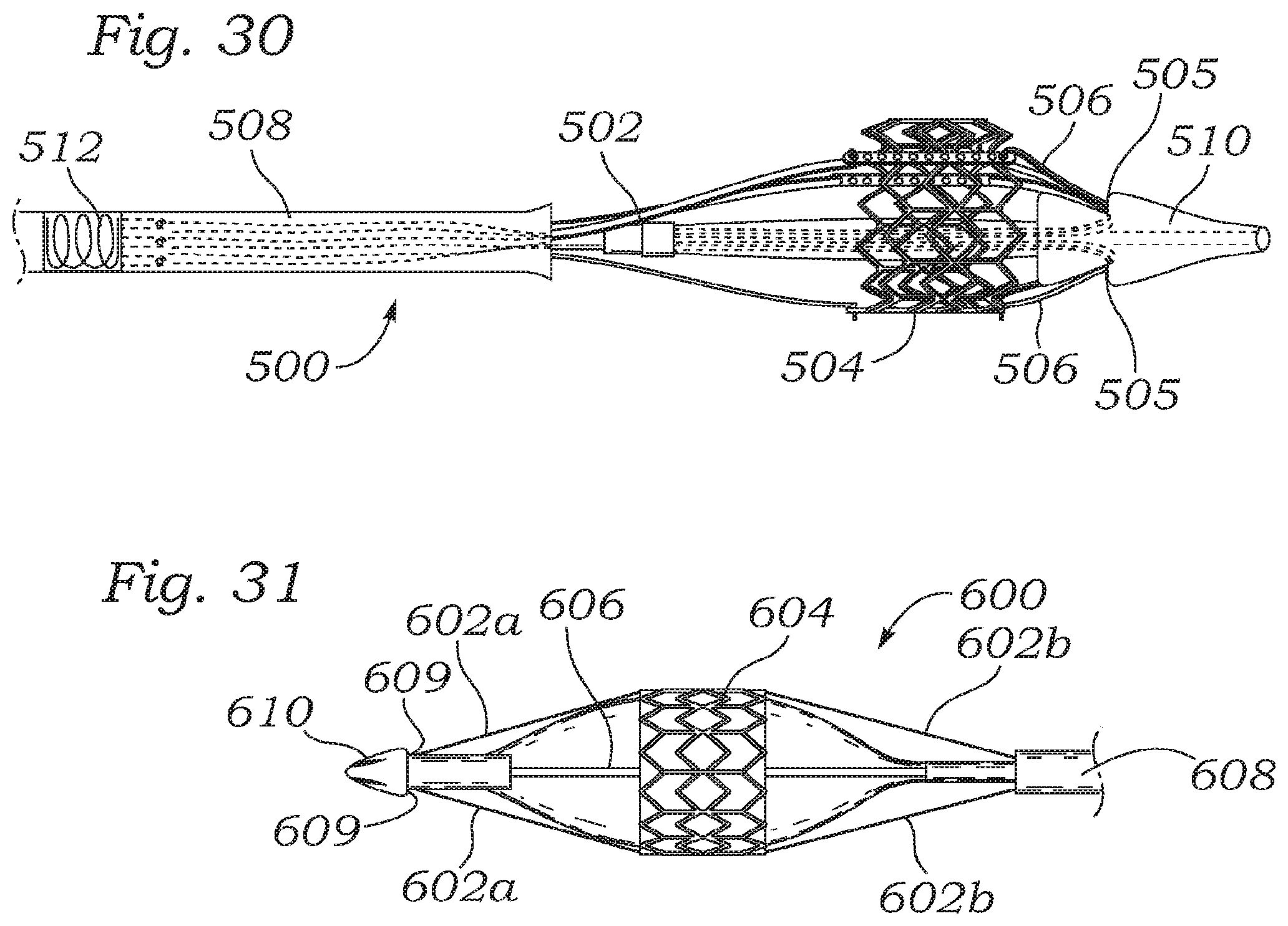 Patent US12350150 Figure 13 – Stability device for use with percutaneous delivery systems