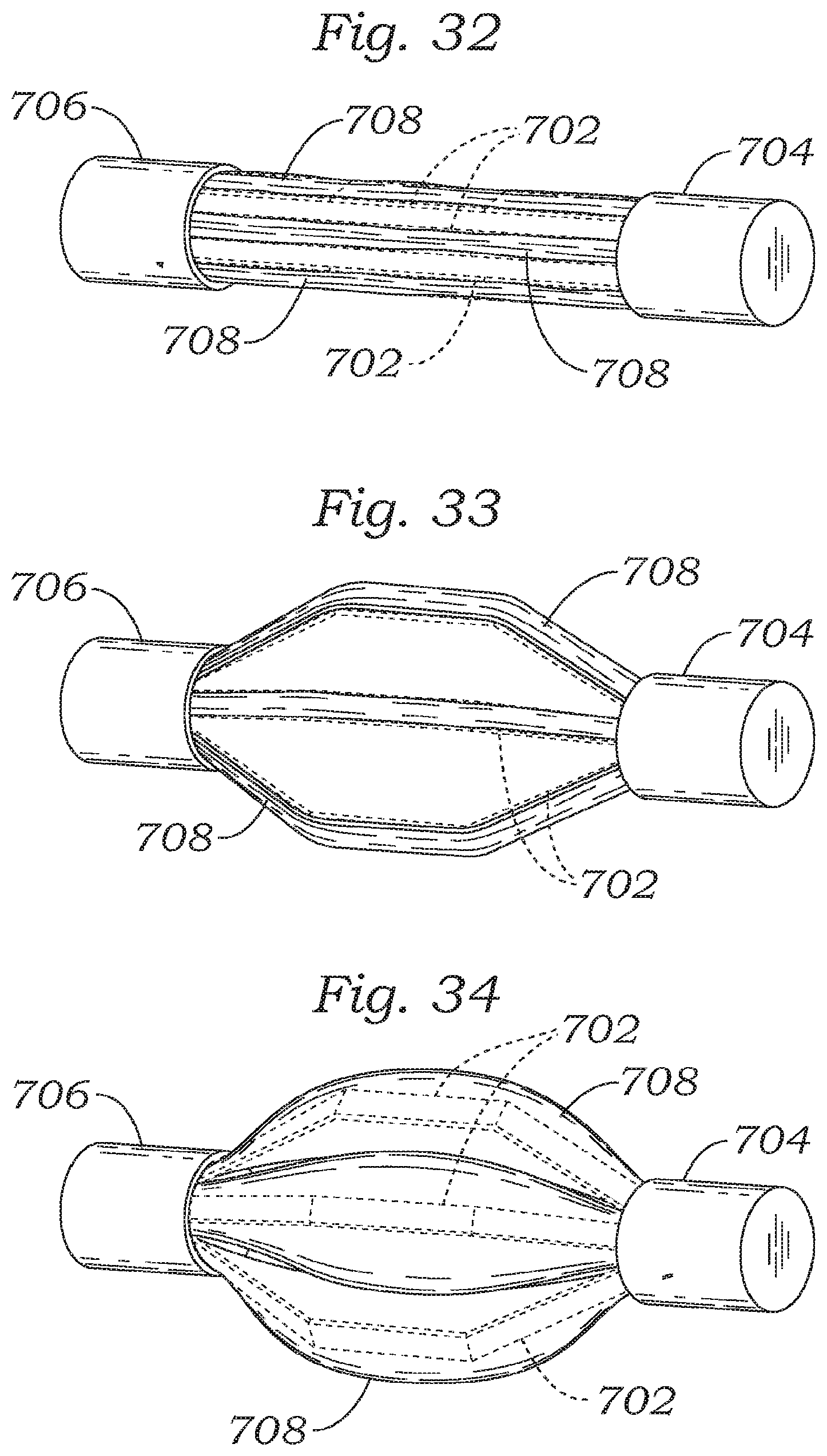 Patent US12350150 Figure 14 – Stability device for use with percutaneous delivery systems