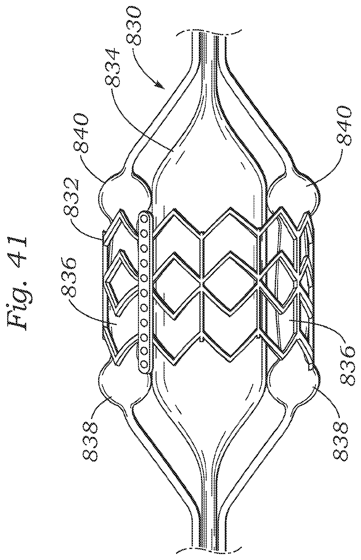 Patent US12350150 Figure 18 – Stability device for use with percutaneous delivery systems