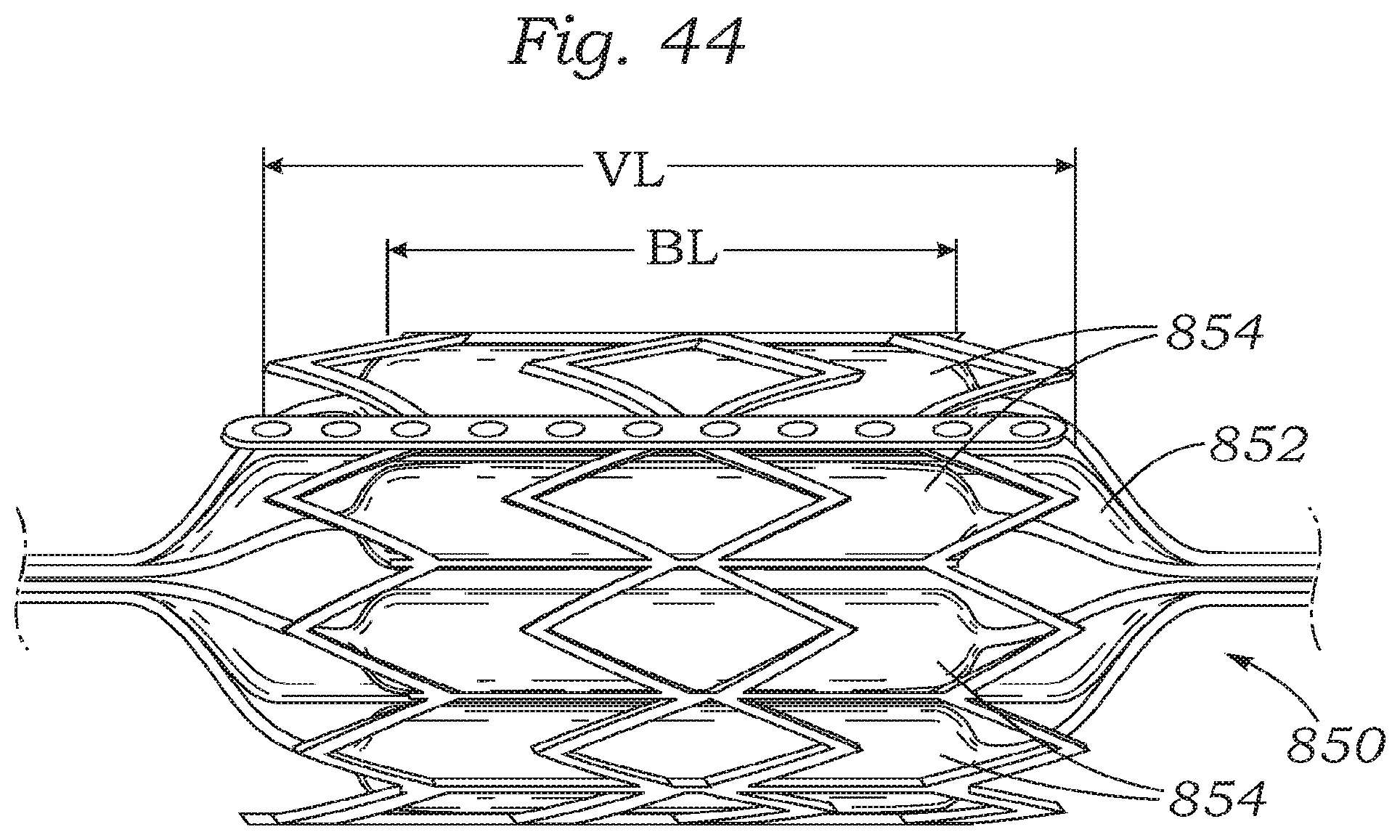 Patent US12350150 Figure 20 – Stability device for use with percutaneous delivery systems