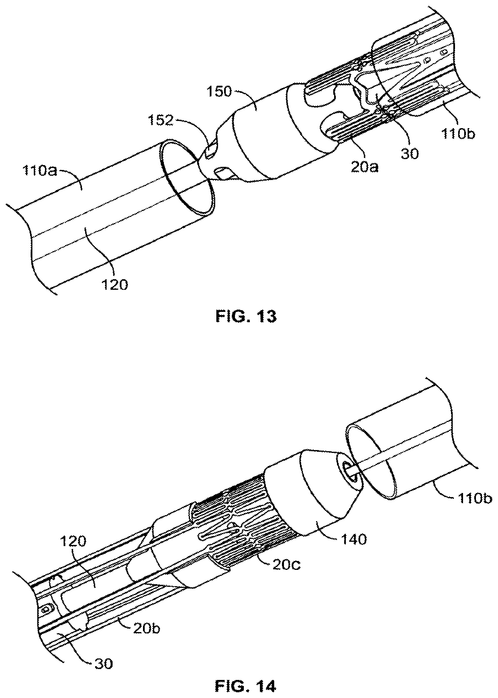 Patent US12350152 Figure 11 – Delivery and retrieval systems for collapsible/expandable prosthetic heart valves