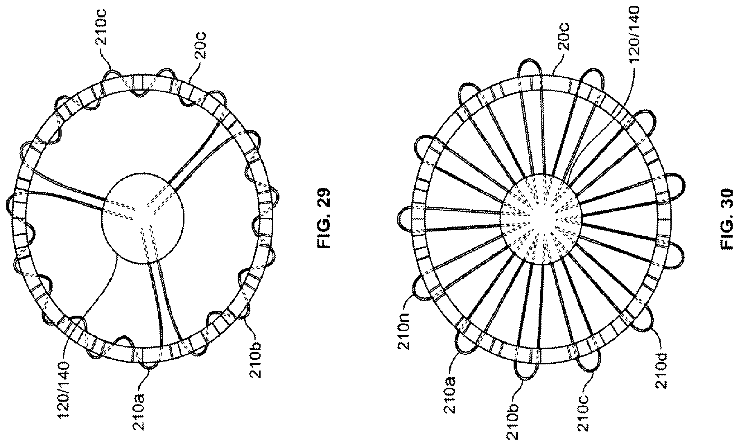 Patent US12350152 Figure 19 – Delivery and retrieval systems for collapsible/expandable prosthetic heart valves