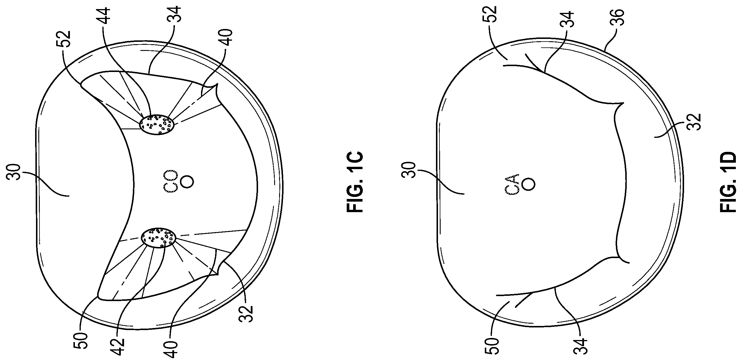 Patent US12350153 Figure 2 – Systems and methods for transcatheter treatment of valve regurgitation