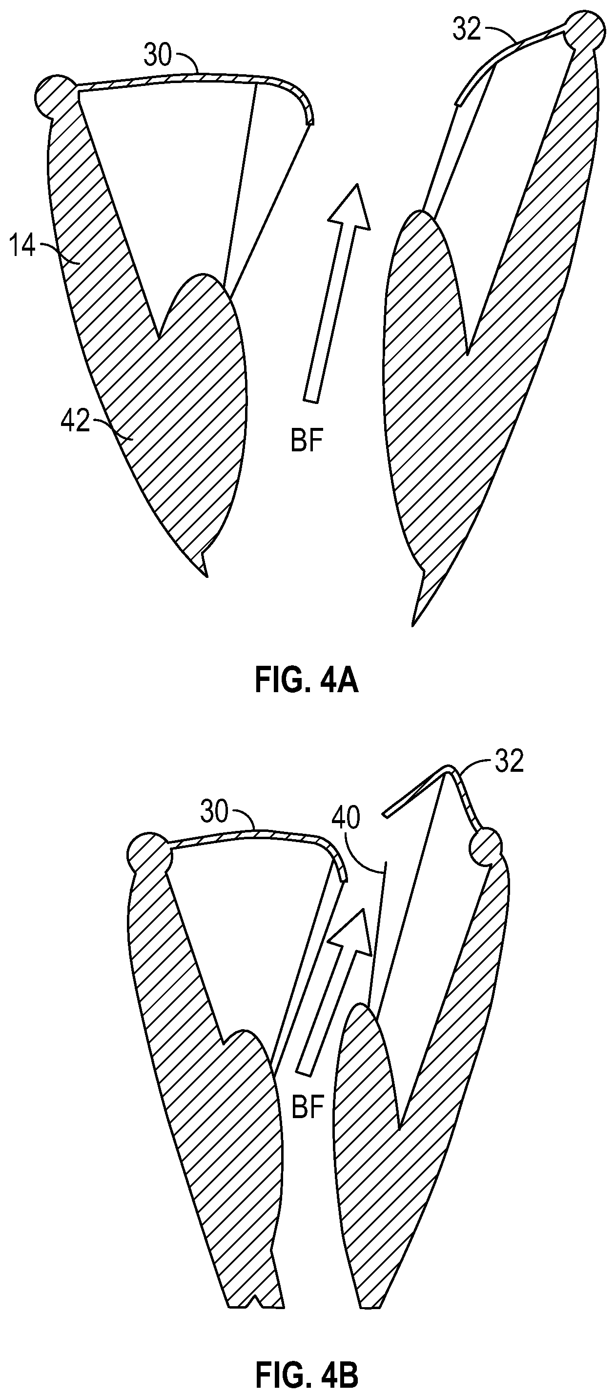 Patent US12350153 Figure 6 – Systems and methods for transcatheter treatment of valve regurgitation